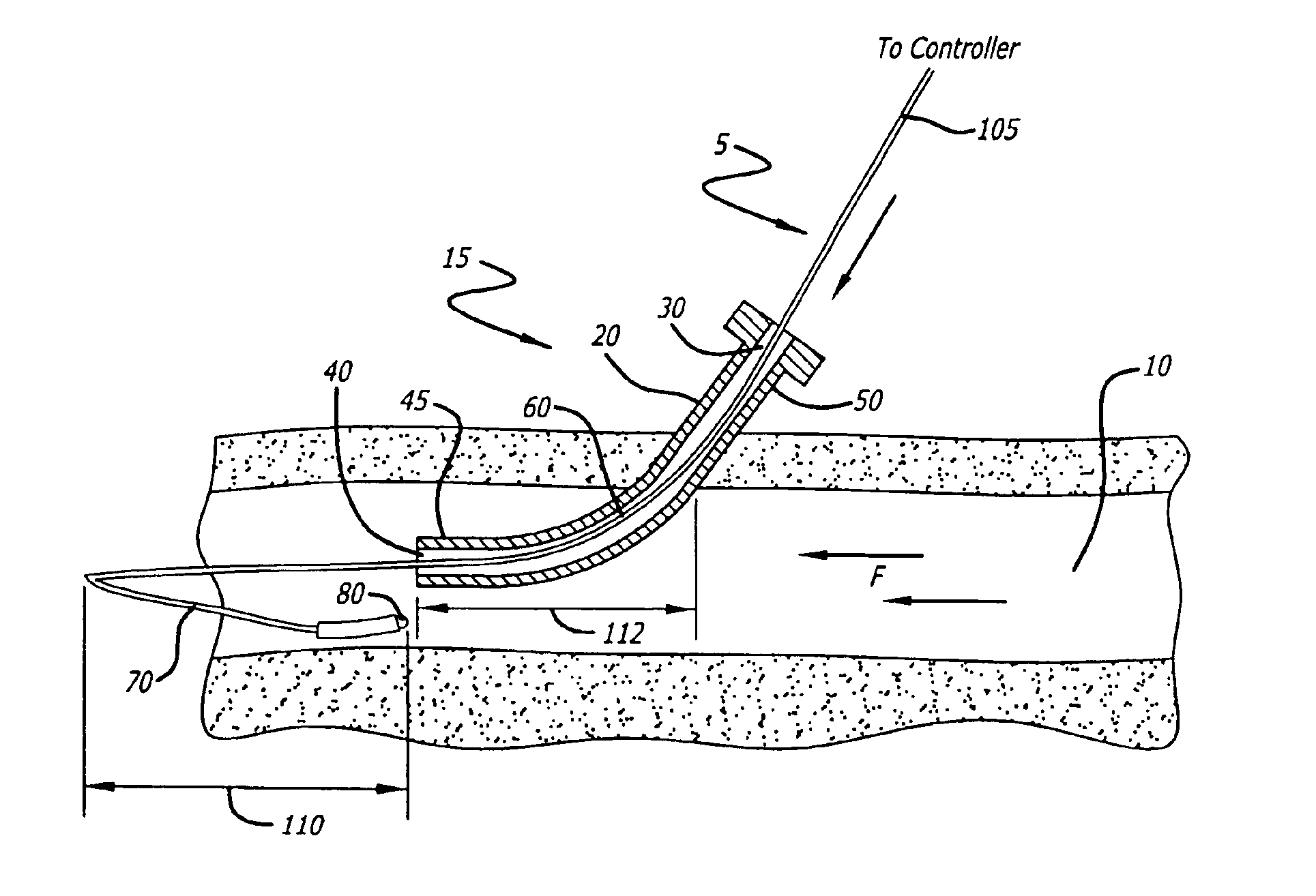 Temperature sensing system with retrograde sensor