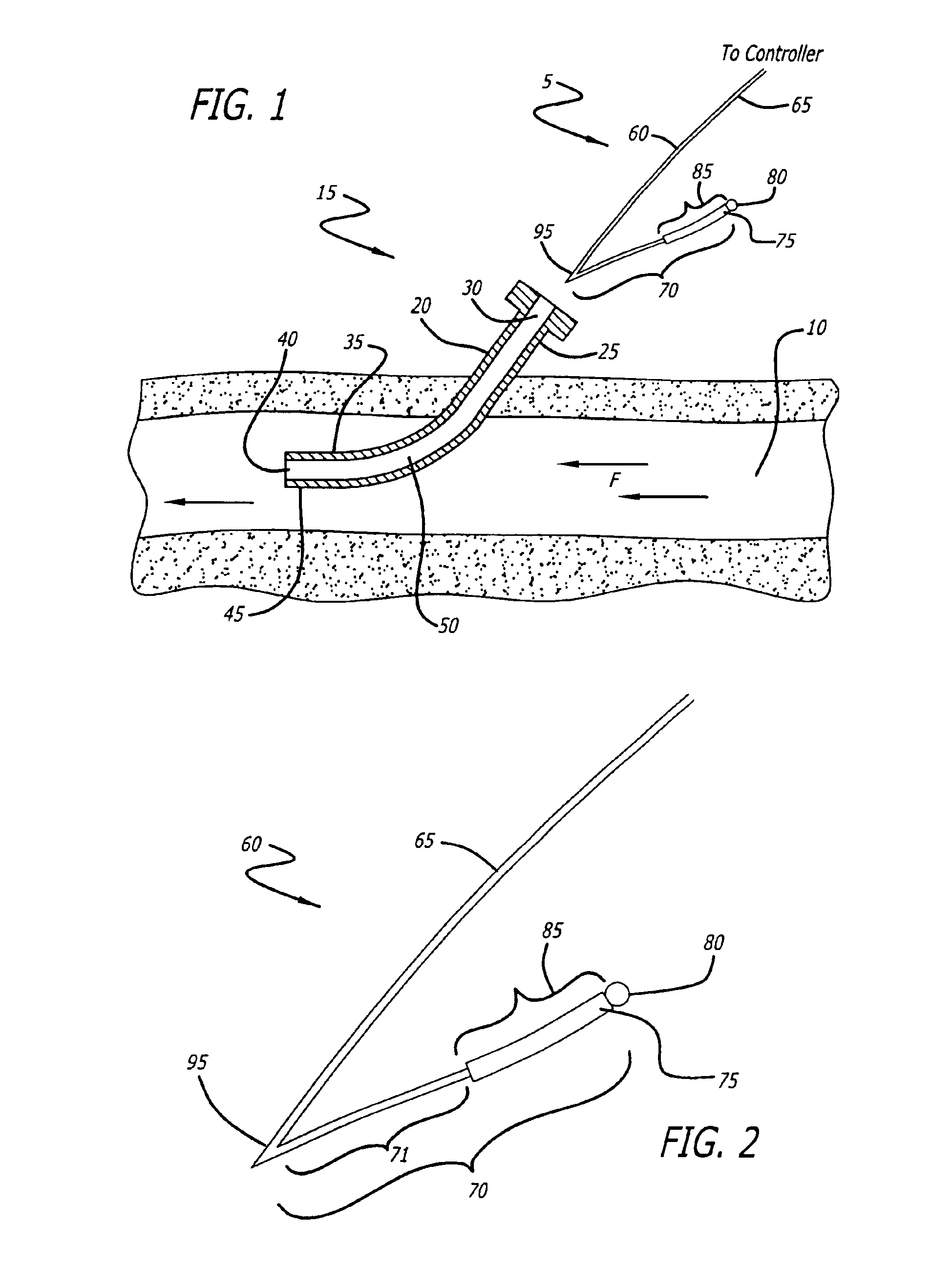 Temperature sensing system with retrograde sensor