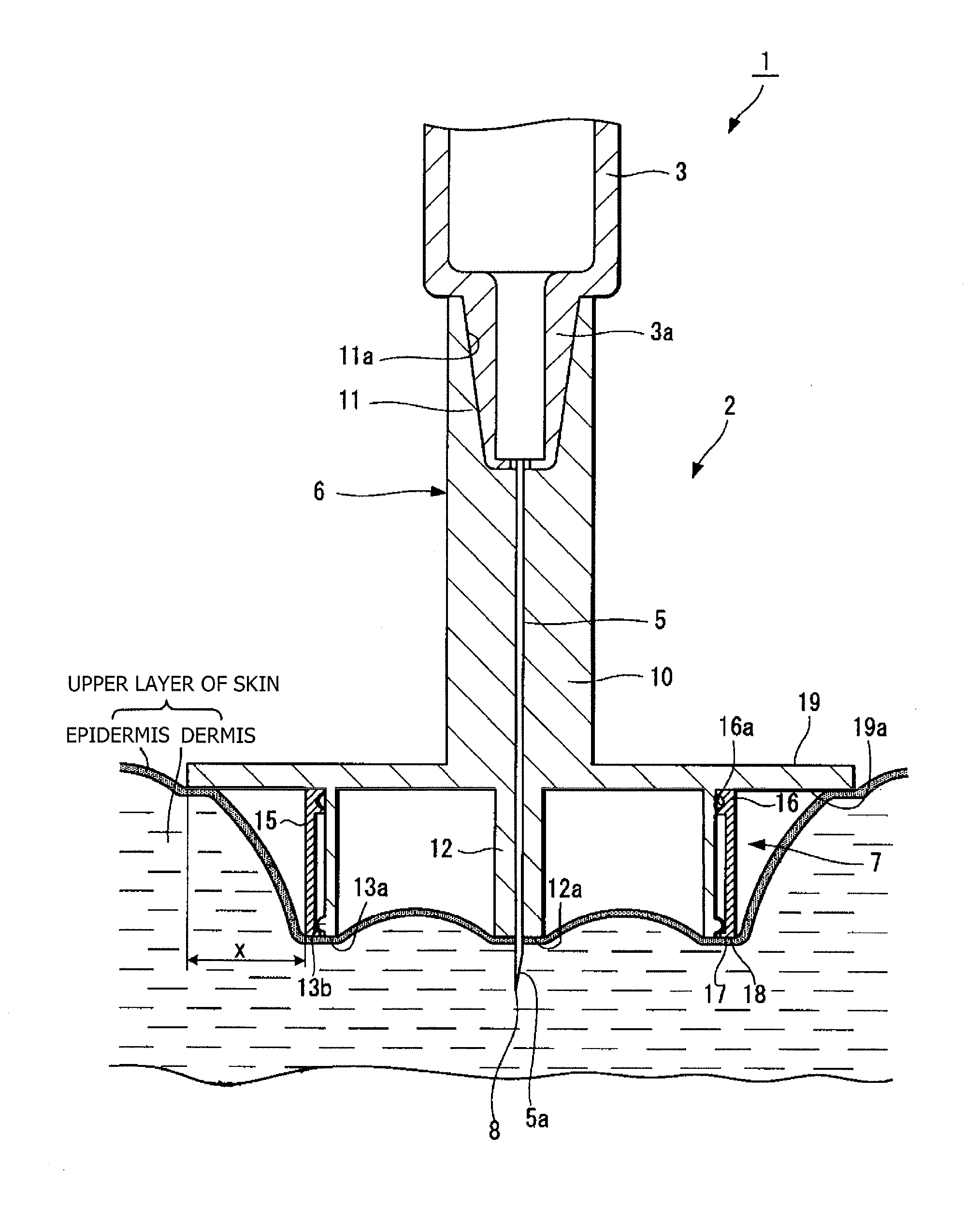 Injection needle assembly and drug injection device