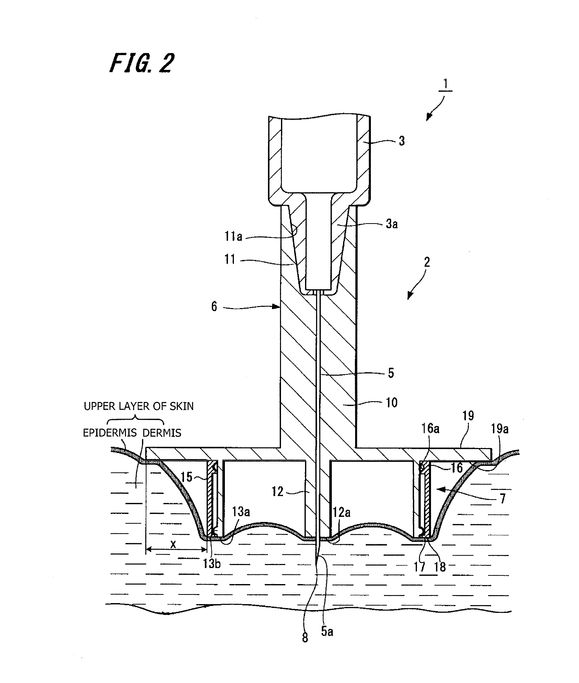 Injection needle assembly and drug injection device