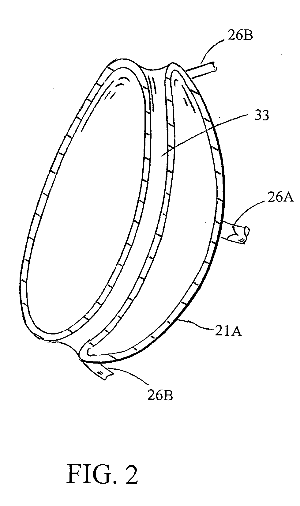 Intragastric space filler