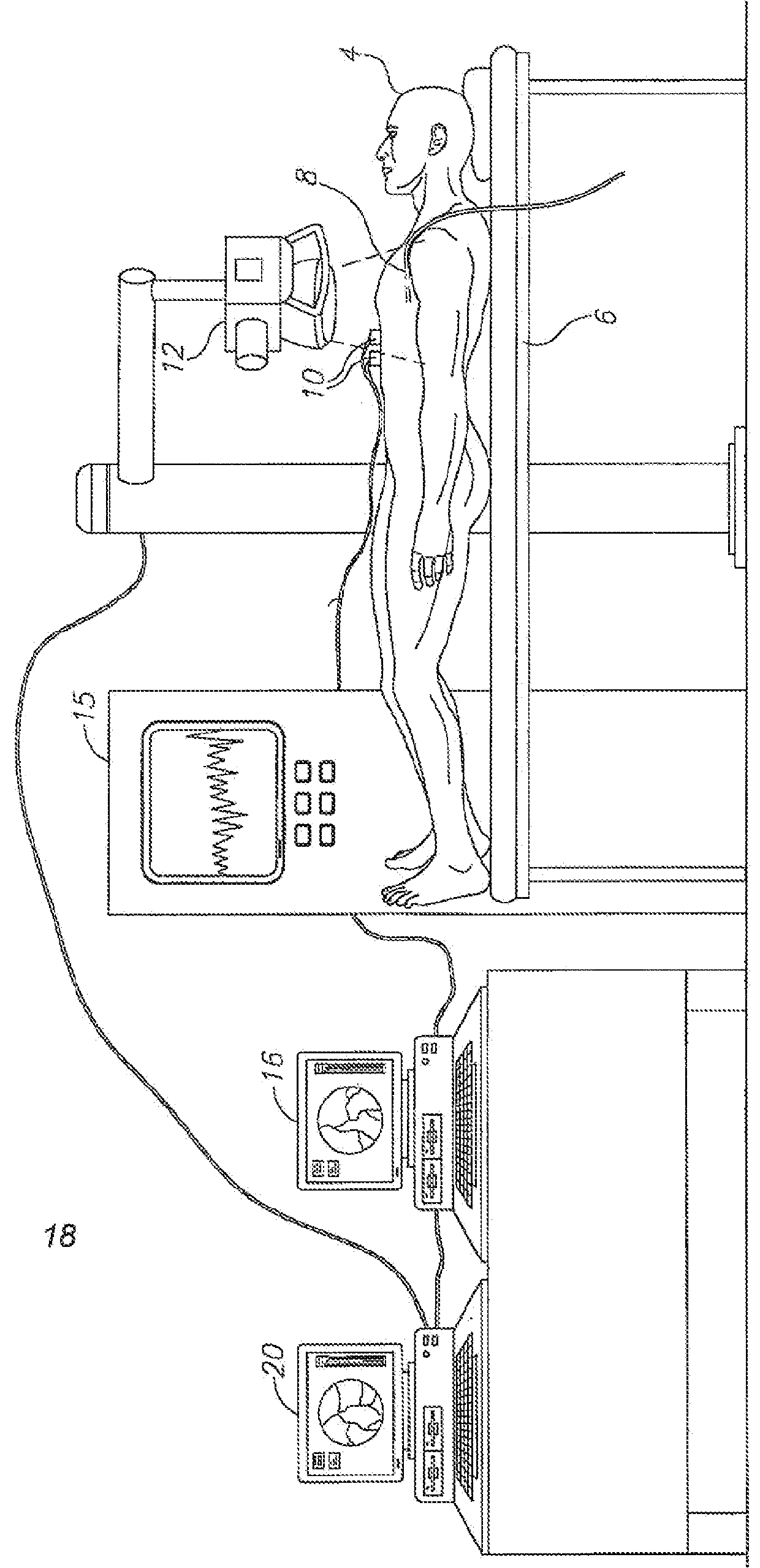 Method and system for detecting and analyzing heart mechanics