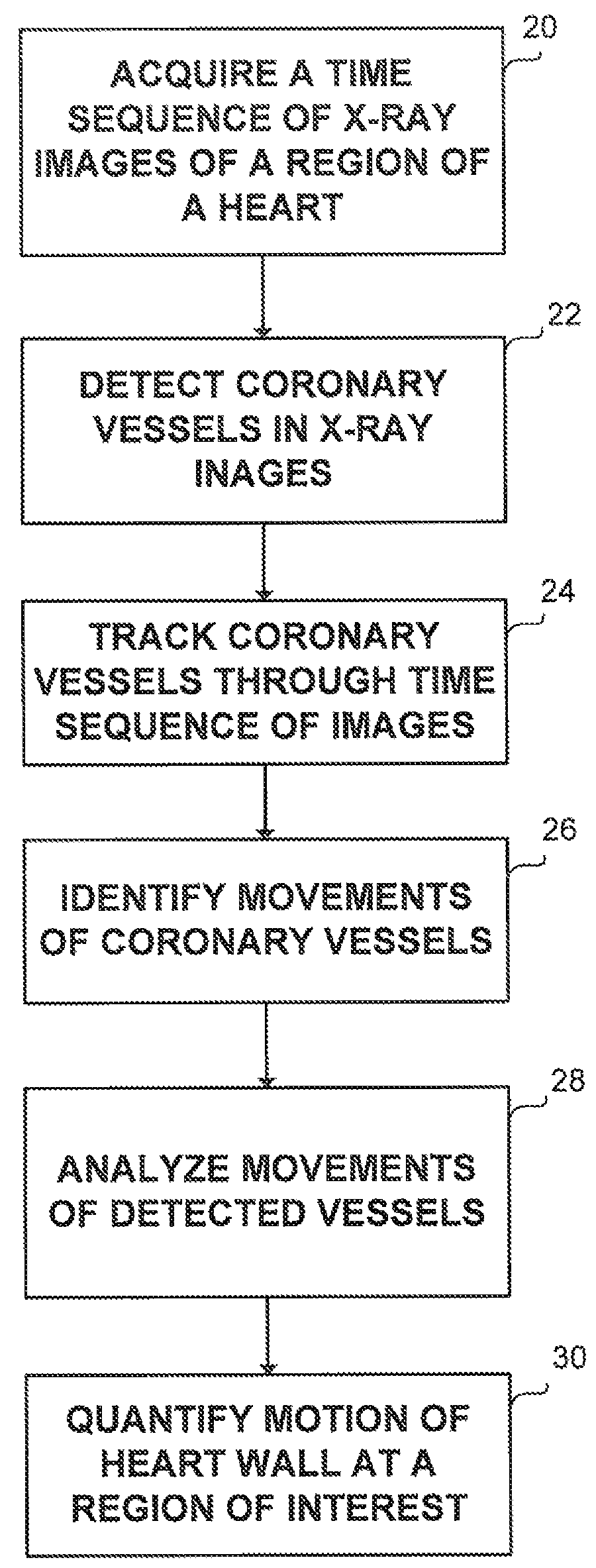 Method and system for detecting and analyzing heart mechanics