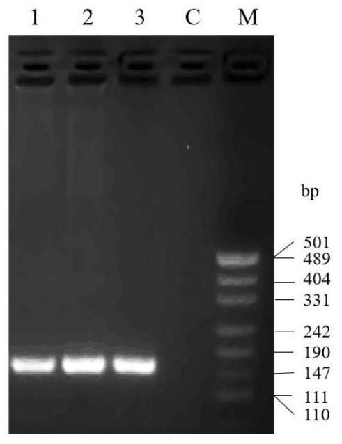 Haplotype molecular markers related to high fecundity of sheep, screening method and application