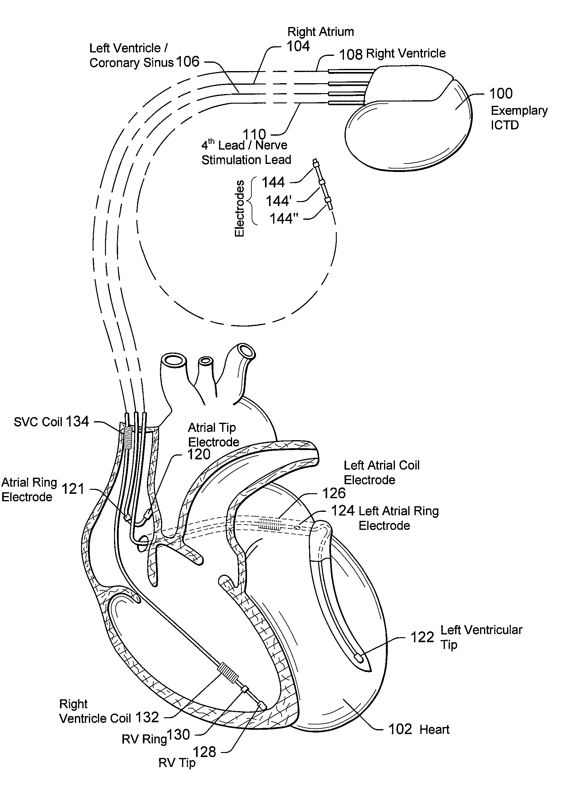 Hybrid battery system for implantable cardiac therapy device