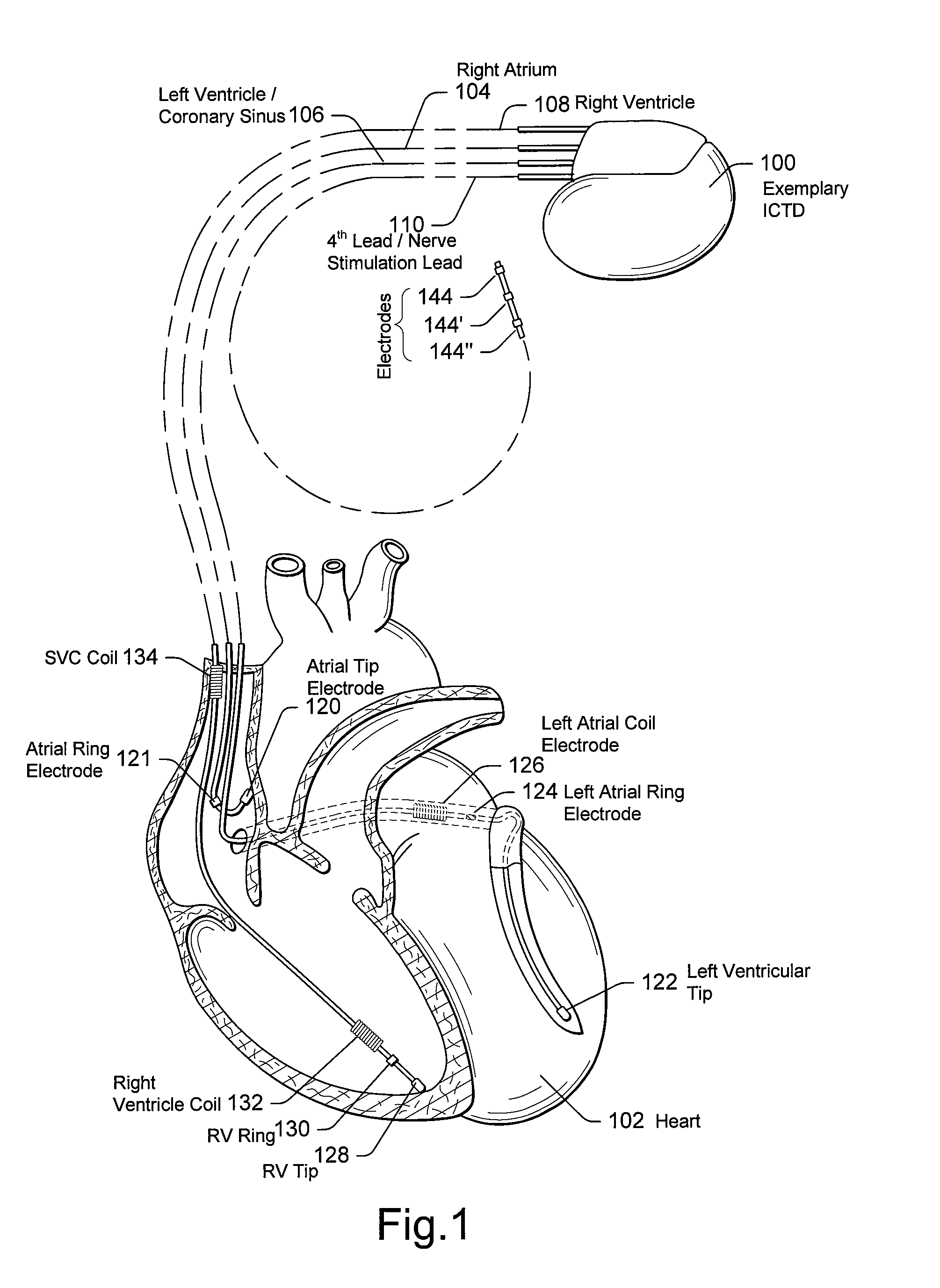 Hybrid battery system for implantable cardiac therapy device