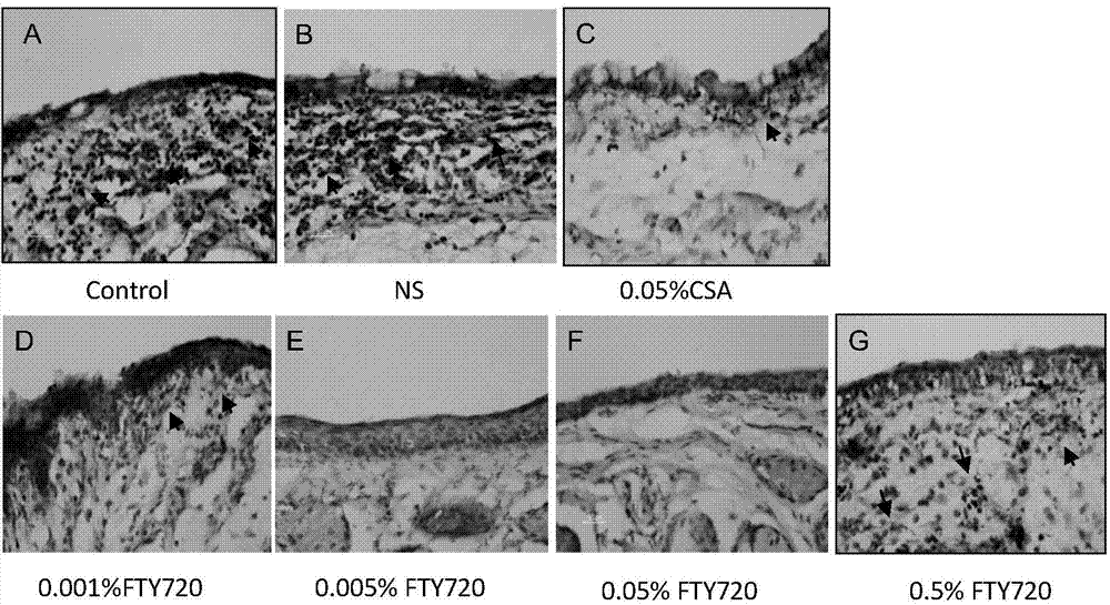 Uses of FTY720 in preparation of xerophthalmia treating drugs