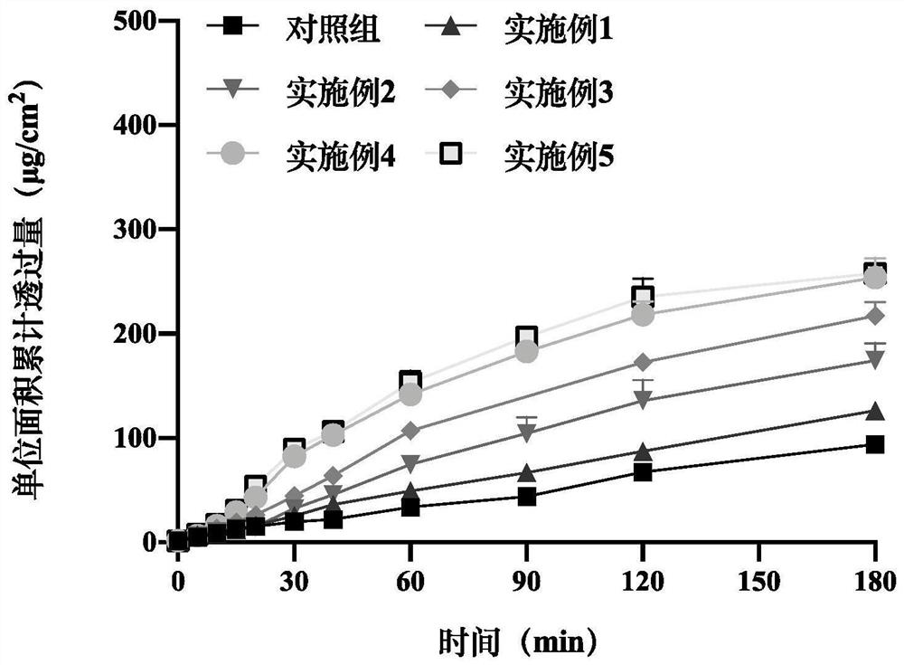 Adrenaline sublingual spray for allergic shock as well as preparation method and application of adrenaline sublingual spray