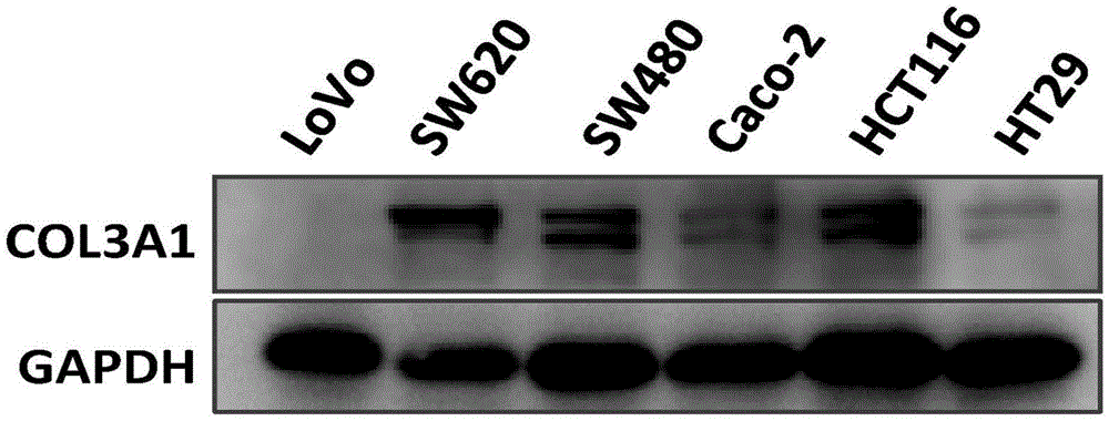 Human colorectal carcinoma molecular marker COL3A1 and application thereof