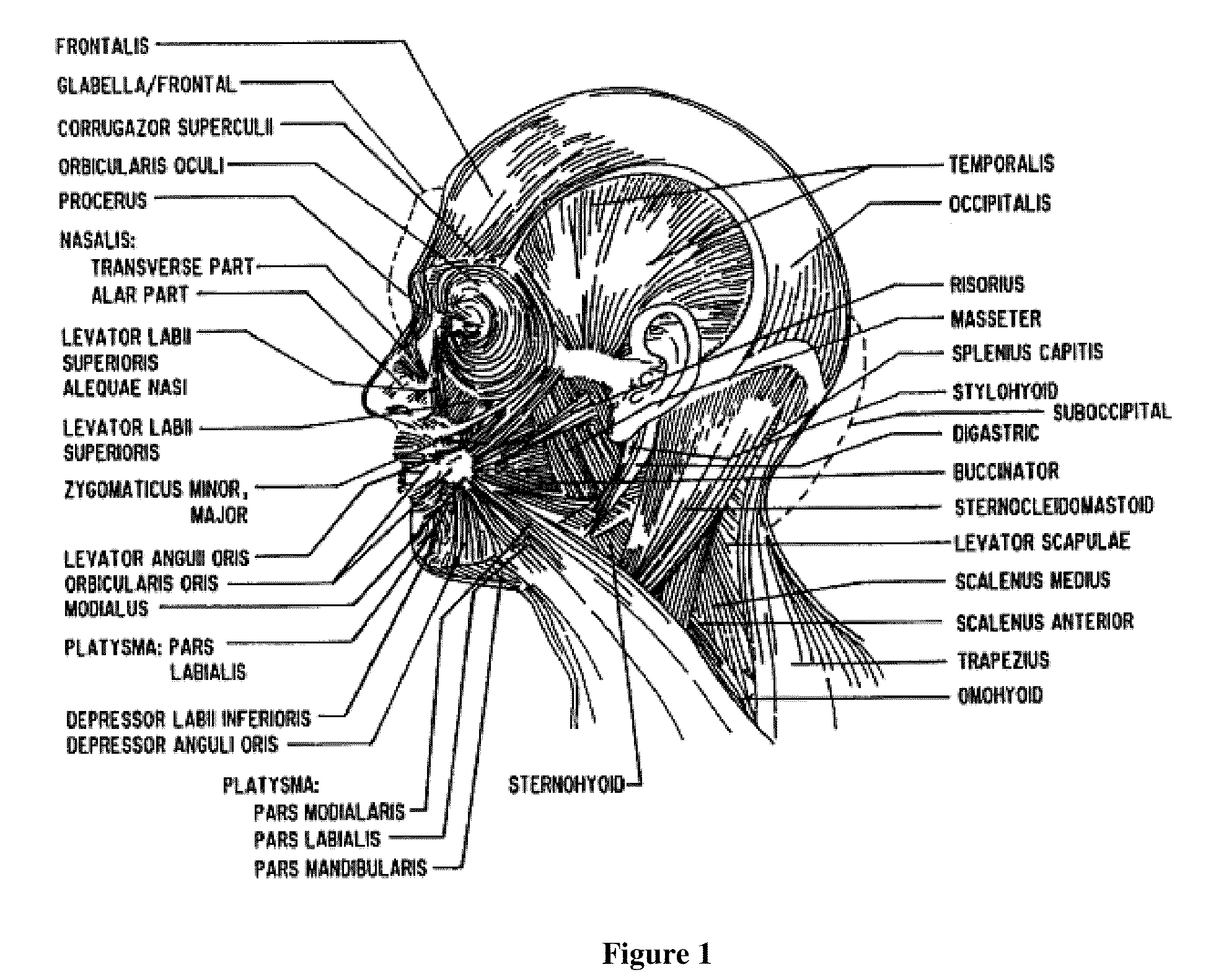 Treatment of headache