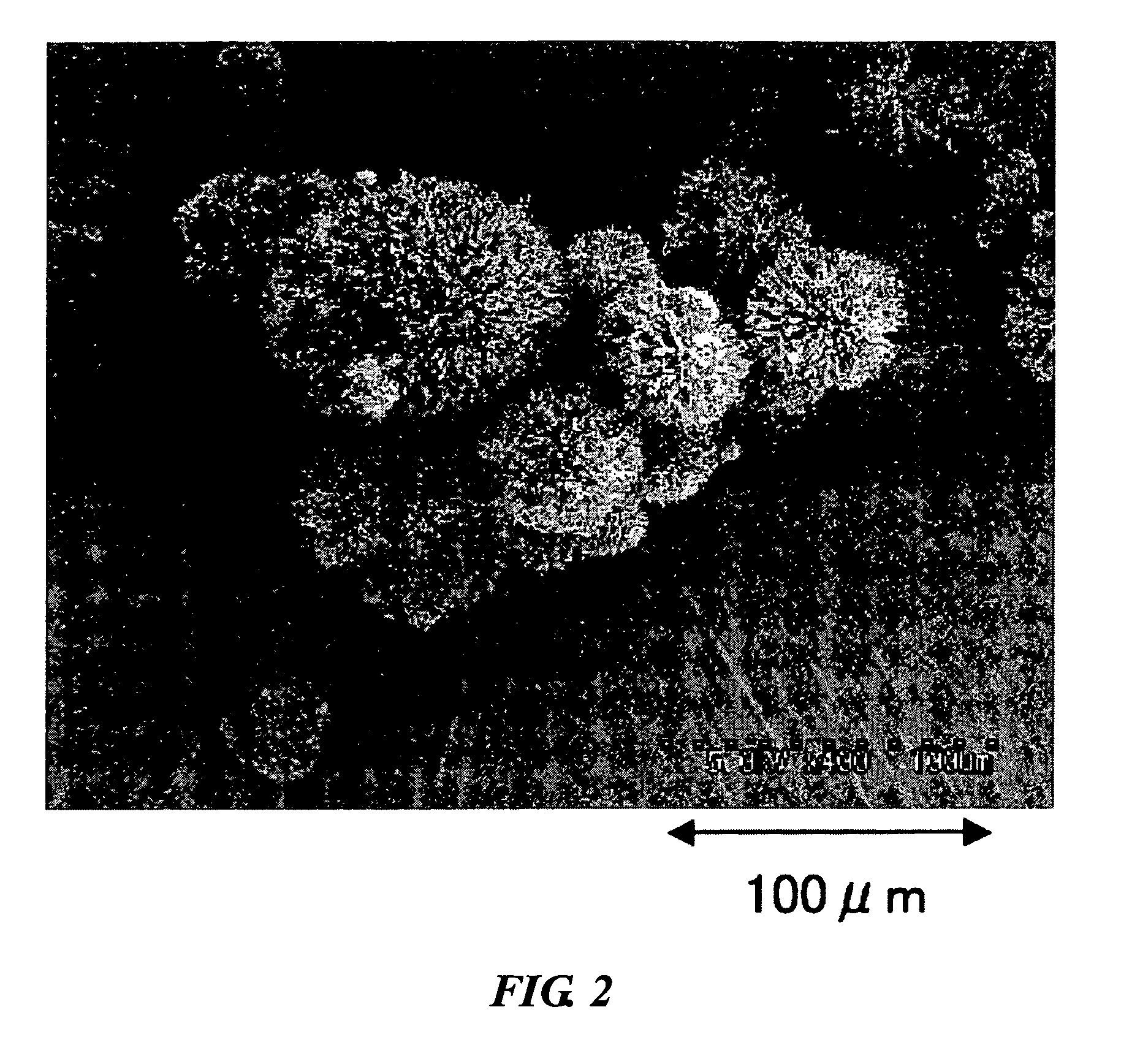 Radial spherical crystallization product, process for producing the same, and dry powder preparation containing the crystallization product