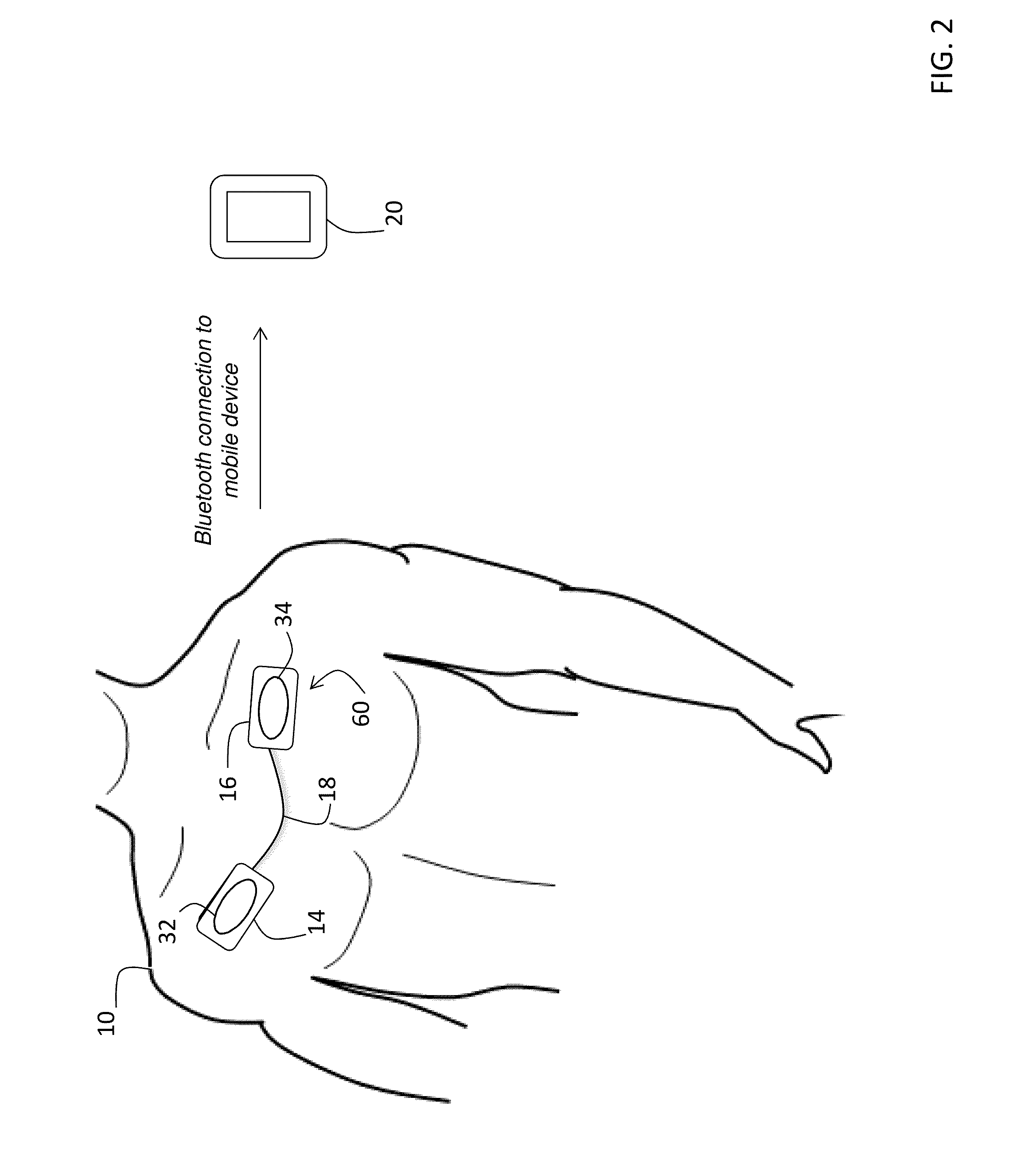 System for electrophysiology that includes software module and body-worn monitor