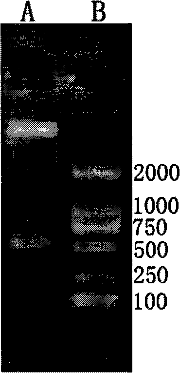 Recombinant expression vector of excretion exudation protein of lung fluke, engineering bacterium, preparation method and uses thereof