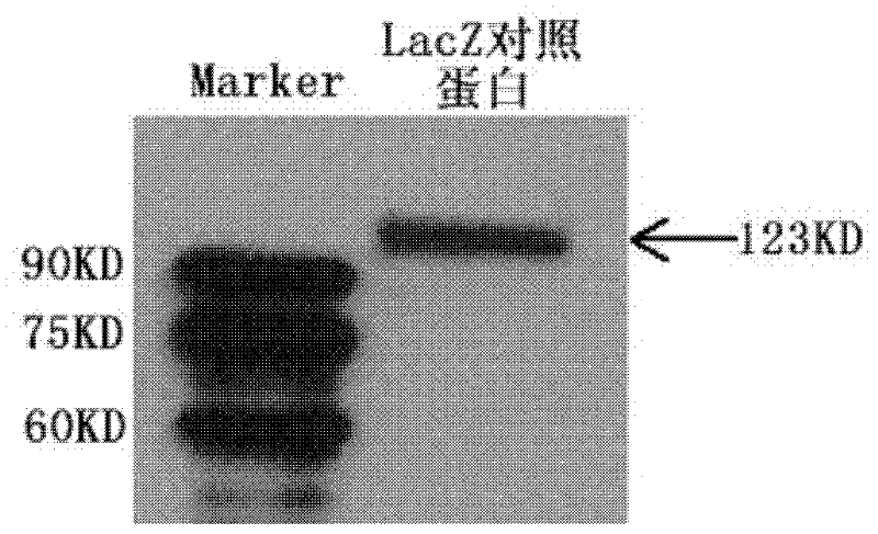 Nucleic acid aptamer capable of identifying HCV E1E2 (hepatitis C virus E1E2), nucleic acid aptamer derivatives and screening method and application thereof