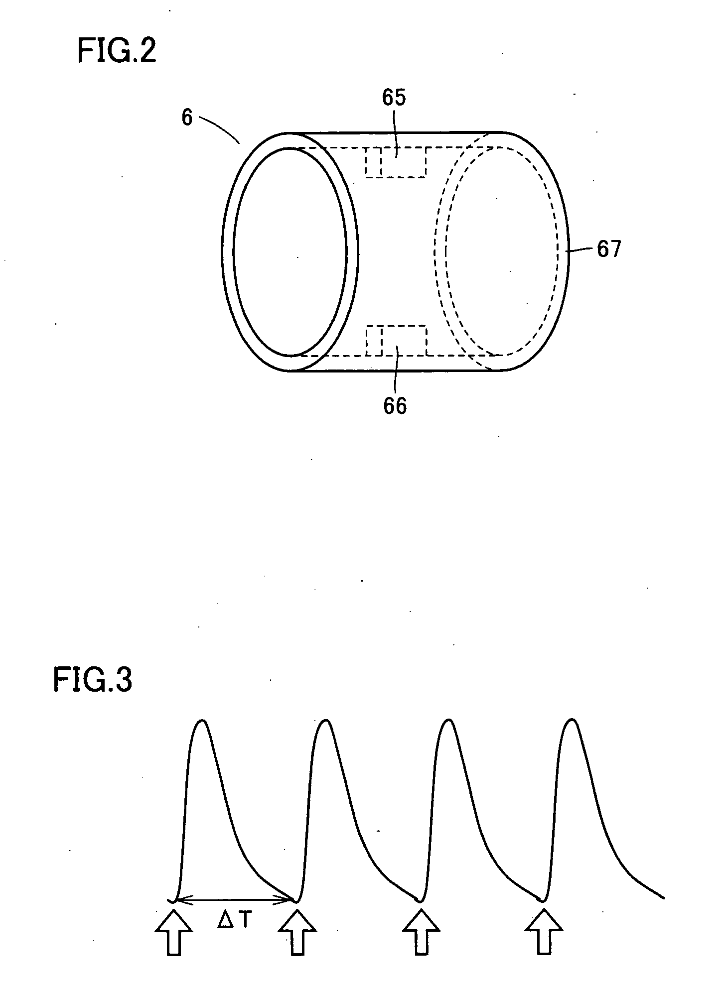 Blood pressure measurement apparatus and method