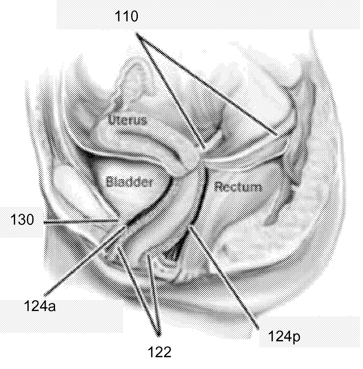 Methods, compositions and kits for surgical repair