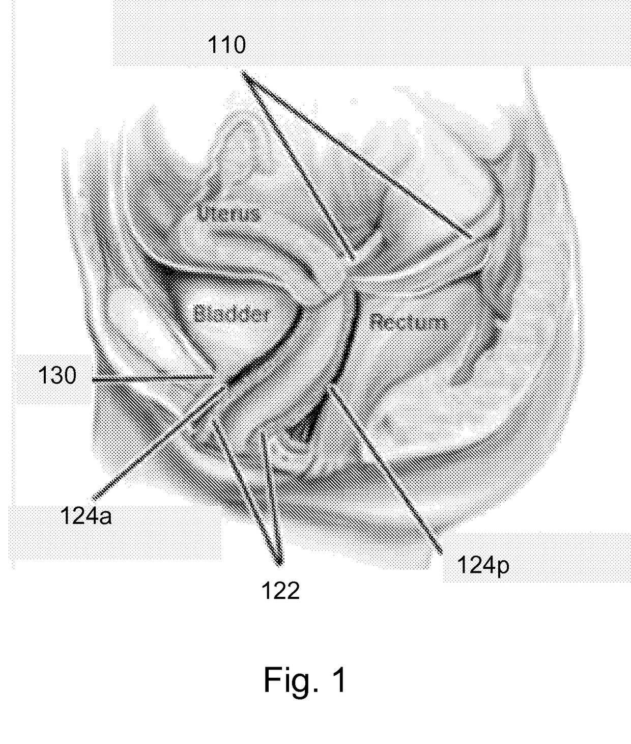 Methods, compositions and kits for surgical repair