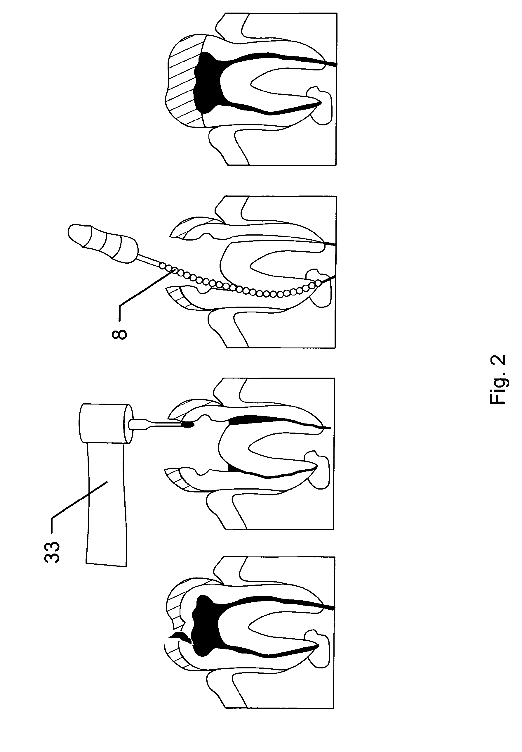 3D digital endodontics