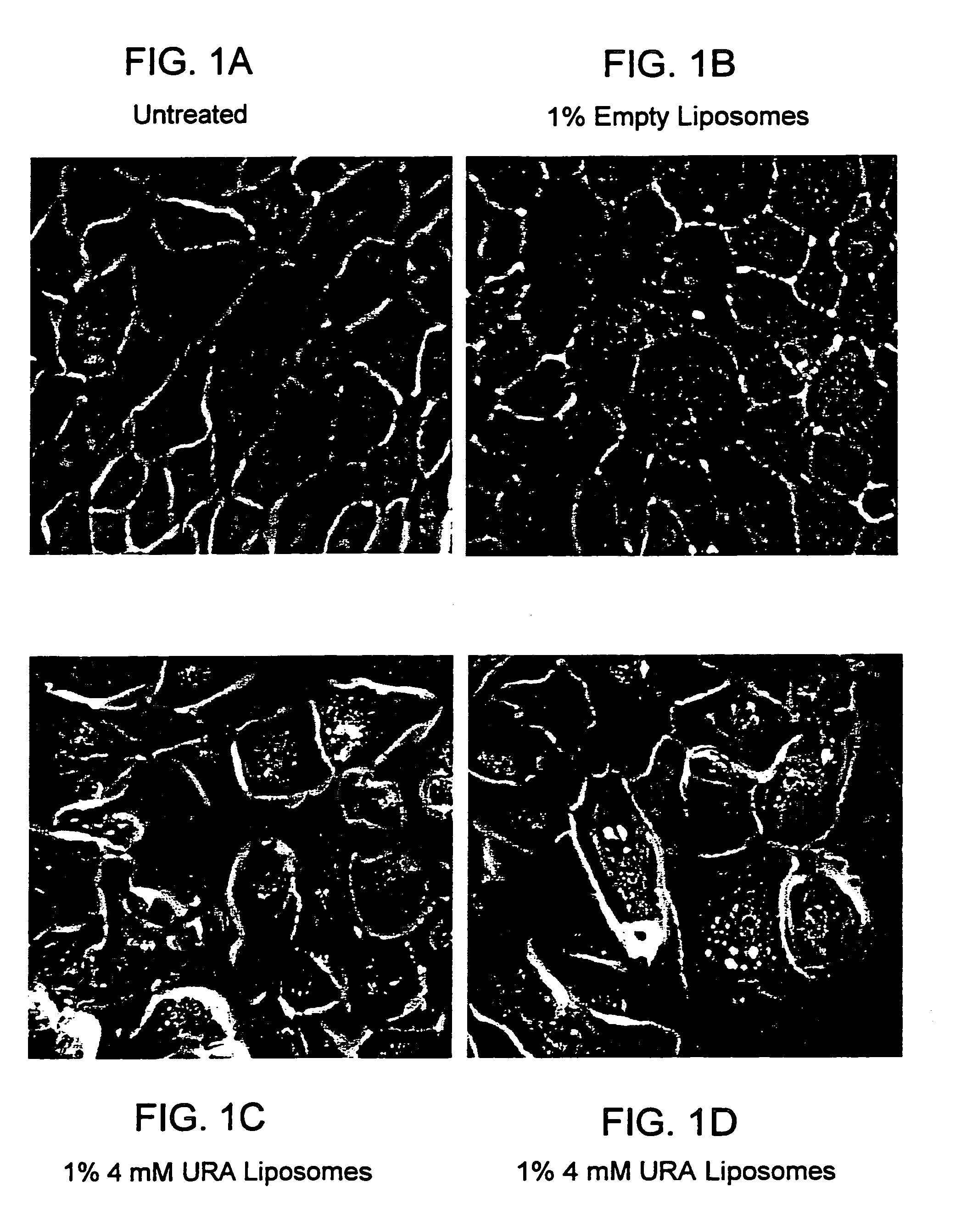 Compositions and methods for modification of skin lipid content