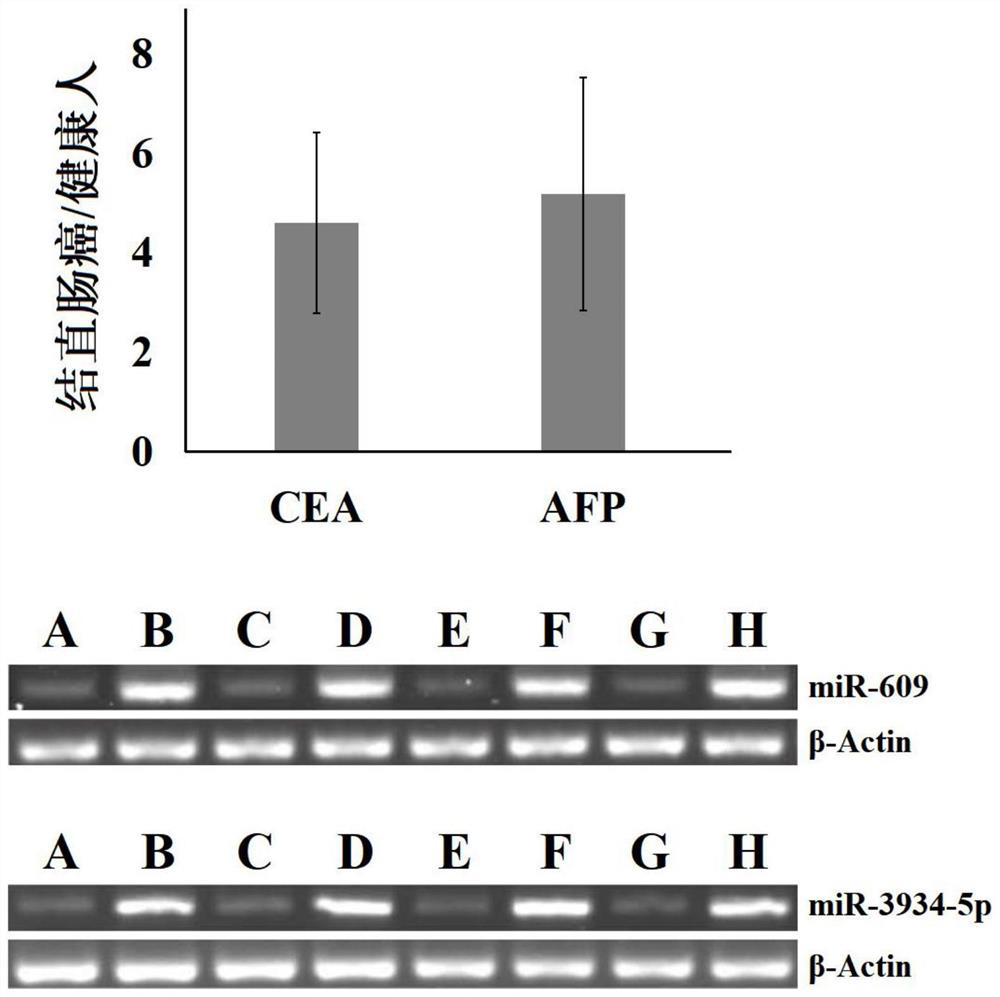 Tumor gene diagnosis marker combined with carcinoembryonic antigen and application of tumor gene diagnosis marker