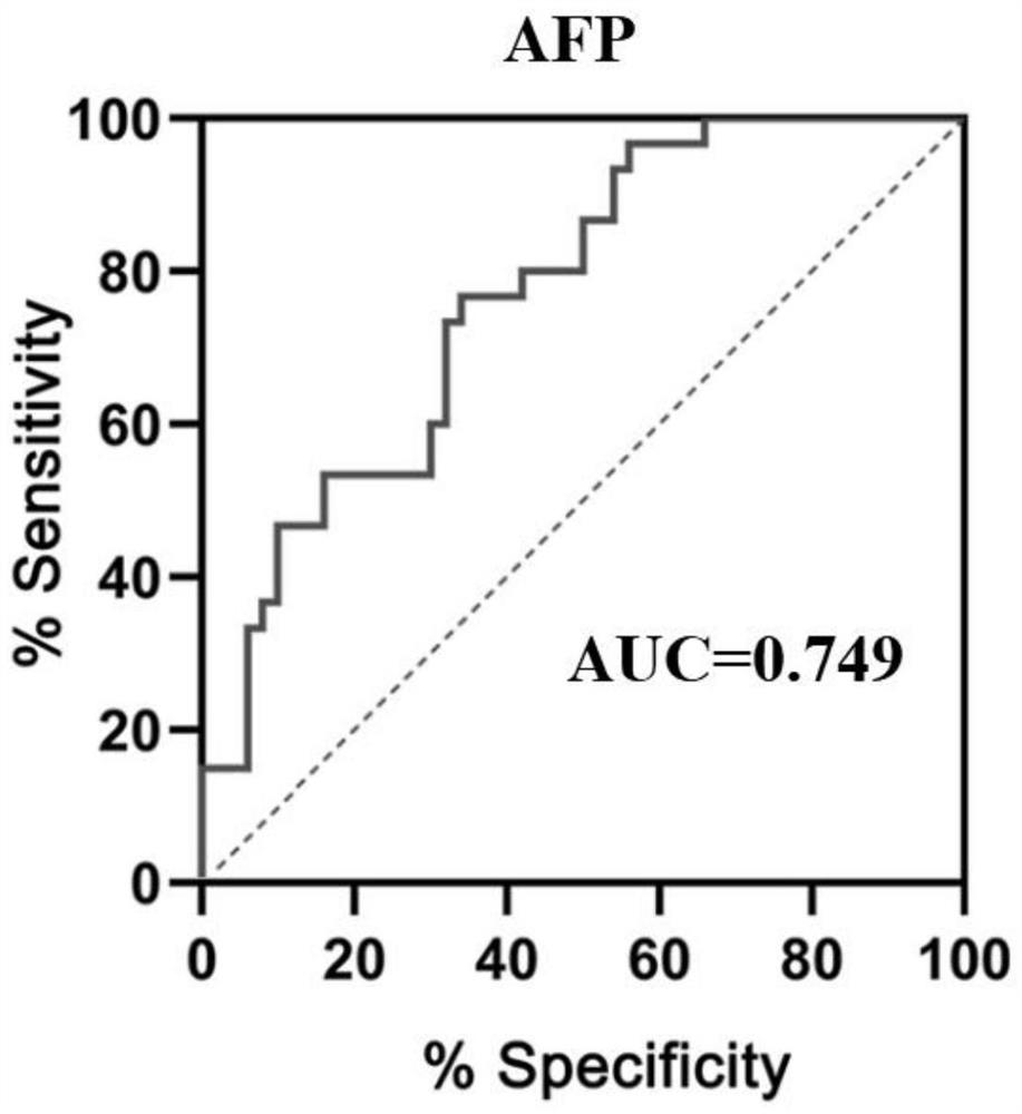 Tumor gene diagnosis marker combined with carcinoembryonic antigen and application of tumor gene diagnosis marker