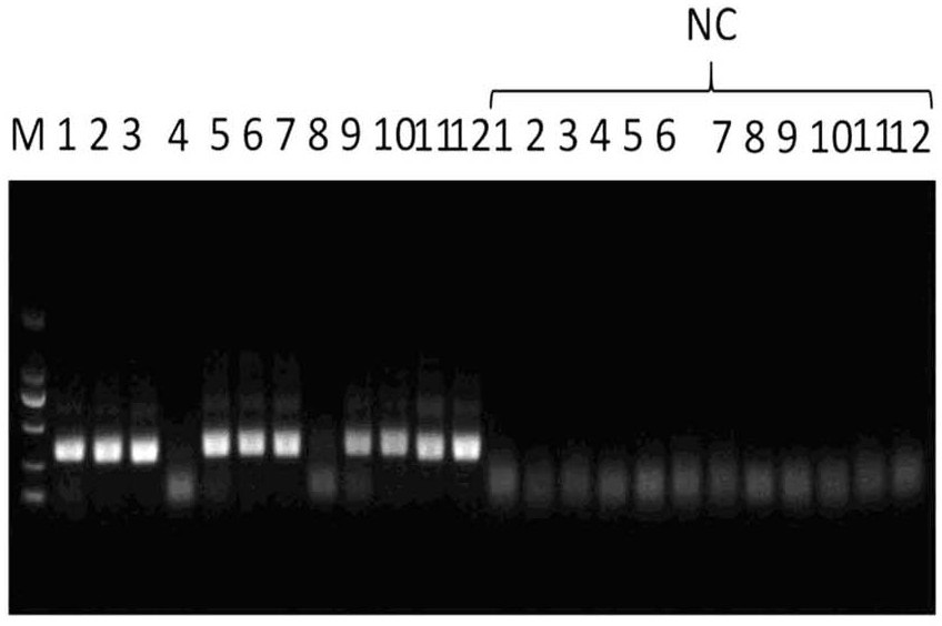 ERA nucleic acid test strip amplification kit for rapidly detecting feline herpes virus, preparation method and detection method