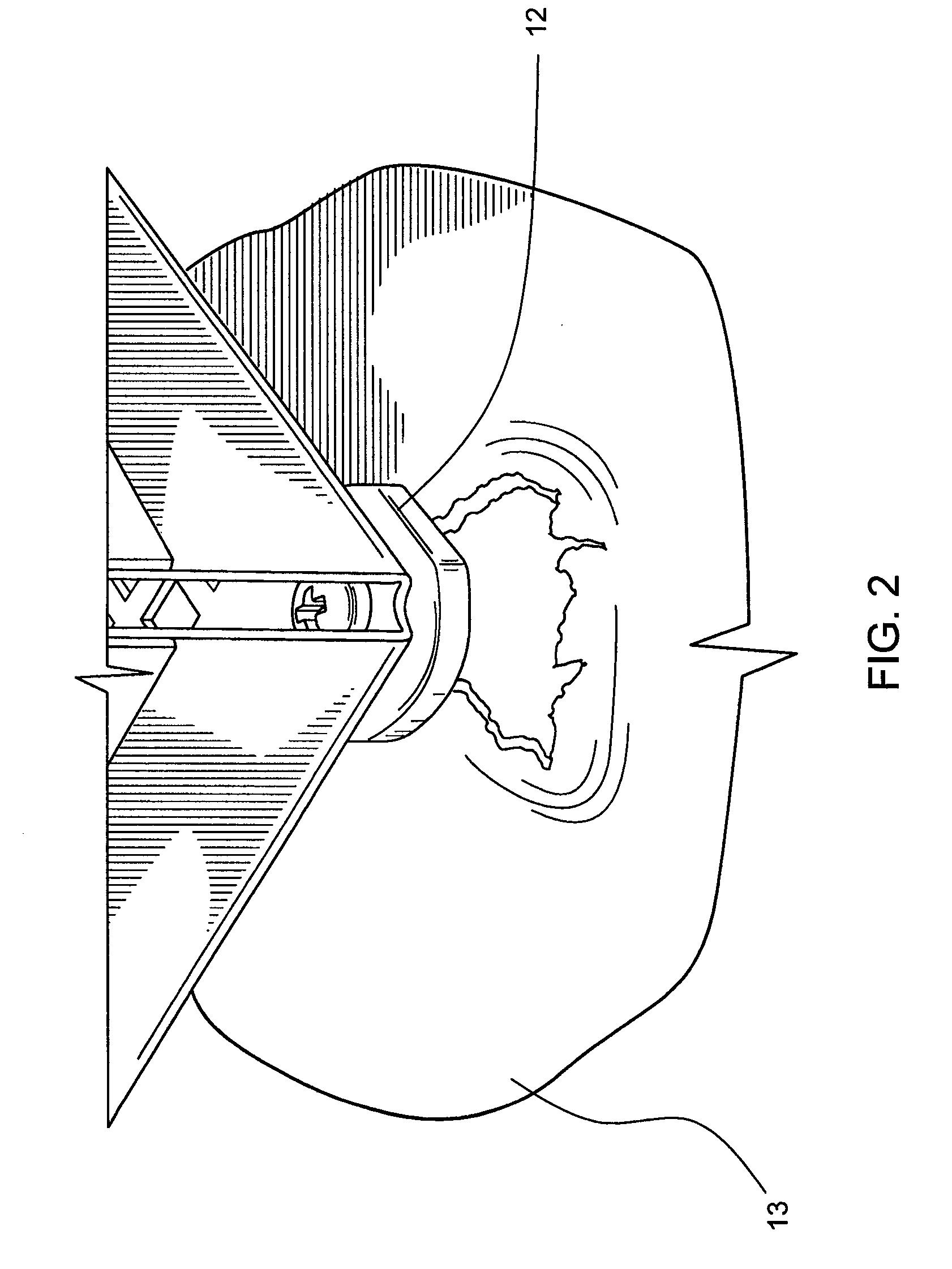 Surgical tray corner protector