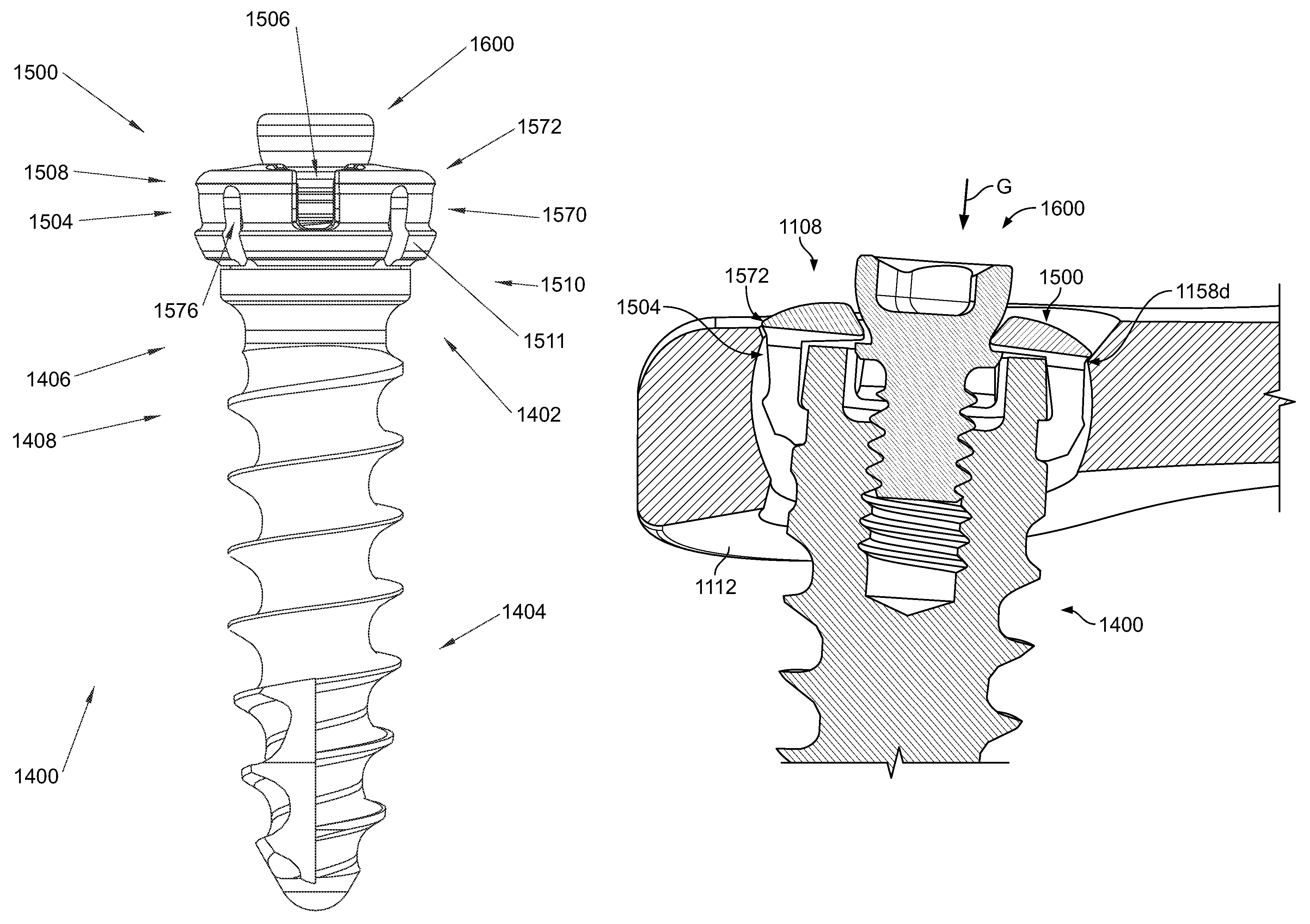 Bone plate system