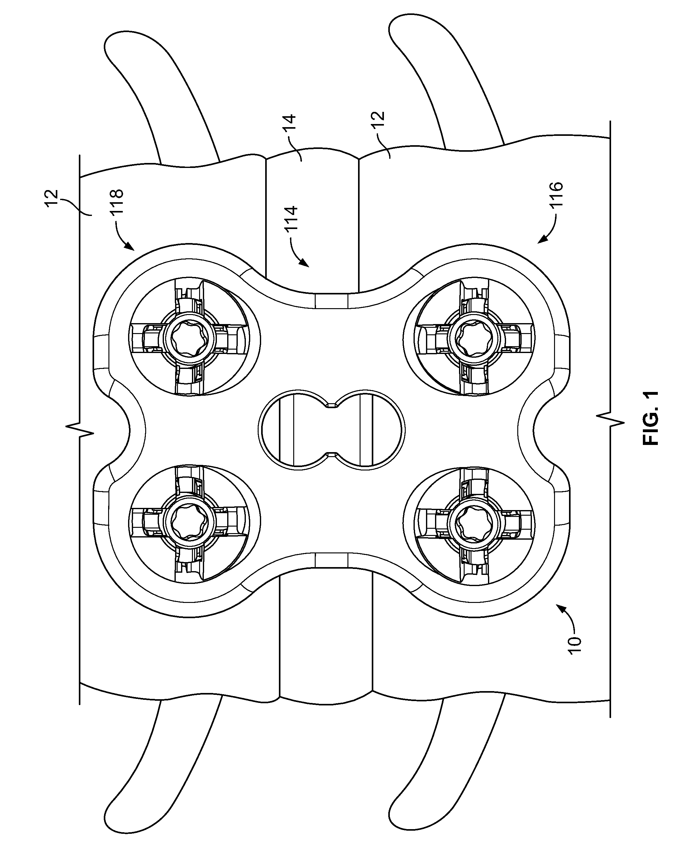 Bone plate system