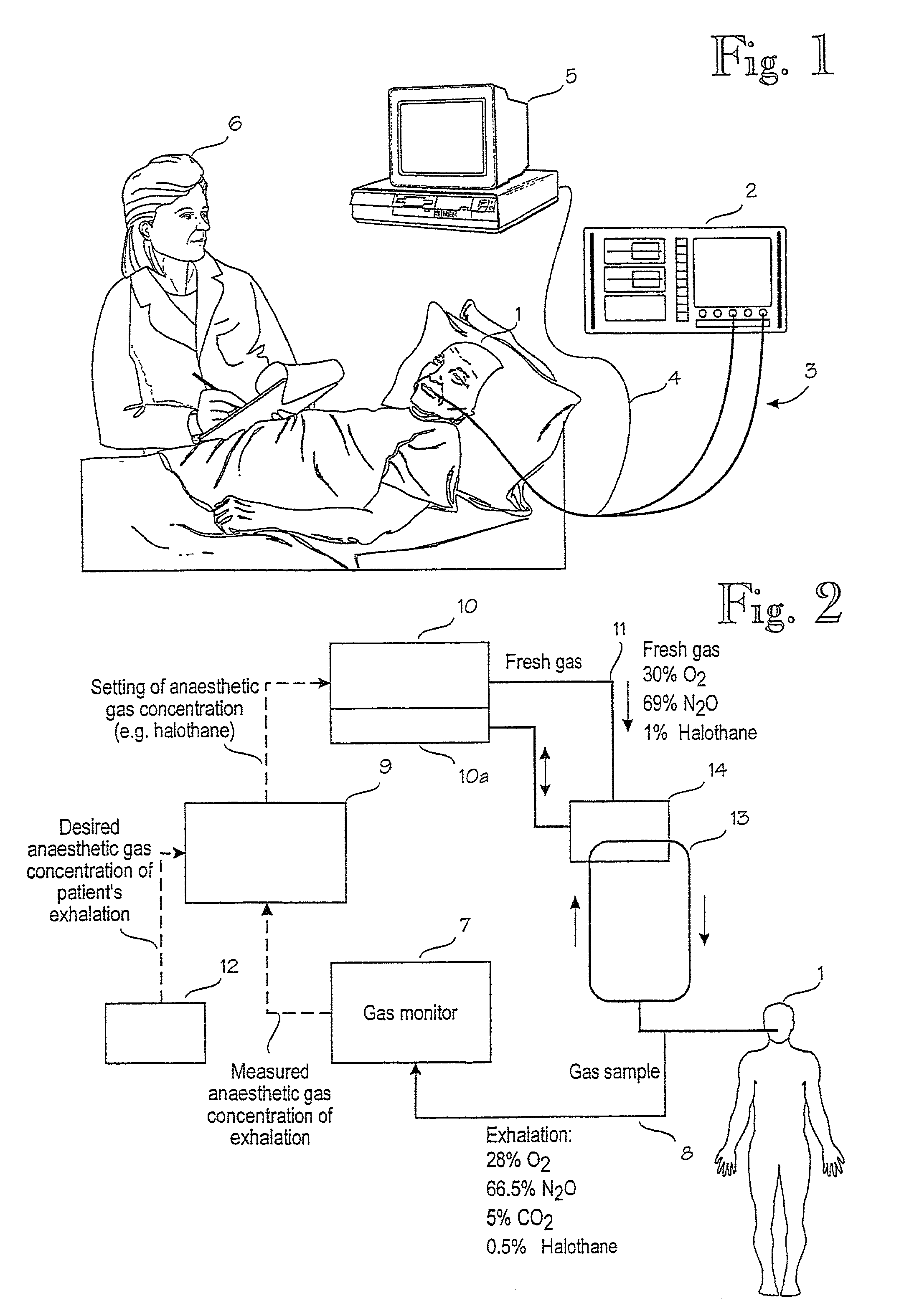 Arrangement in connection with feedback control system