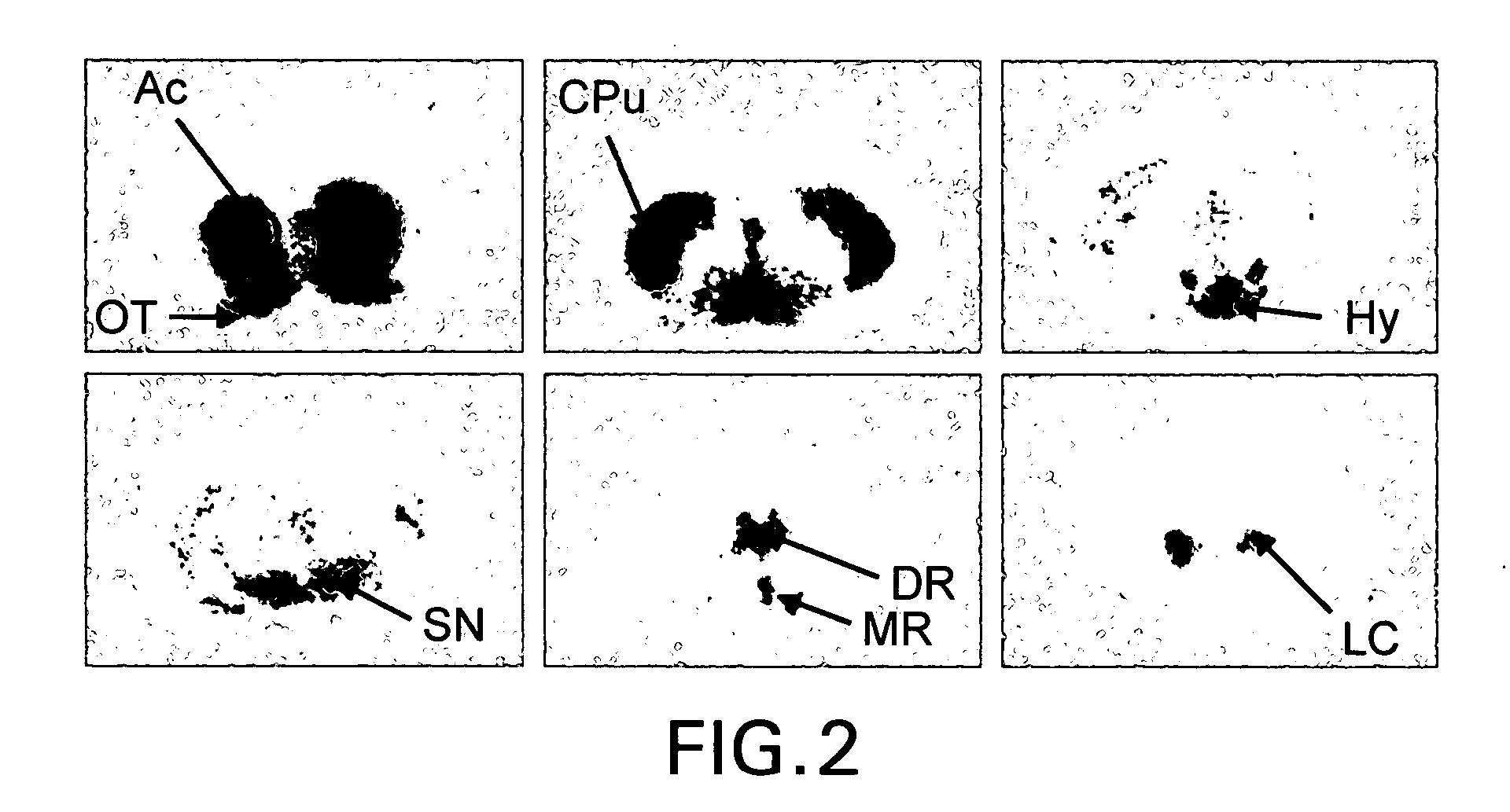 Radiolabeled dihydrotetrabenazine derivatives and their use as imaging agents