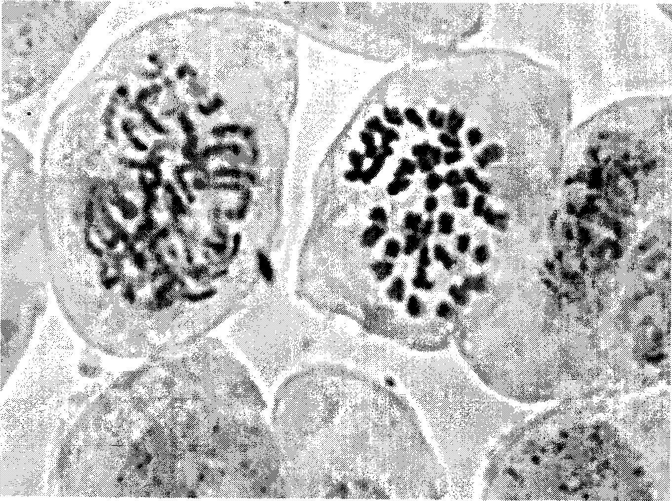 Tabletting method for locust stem tip chromosome