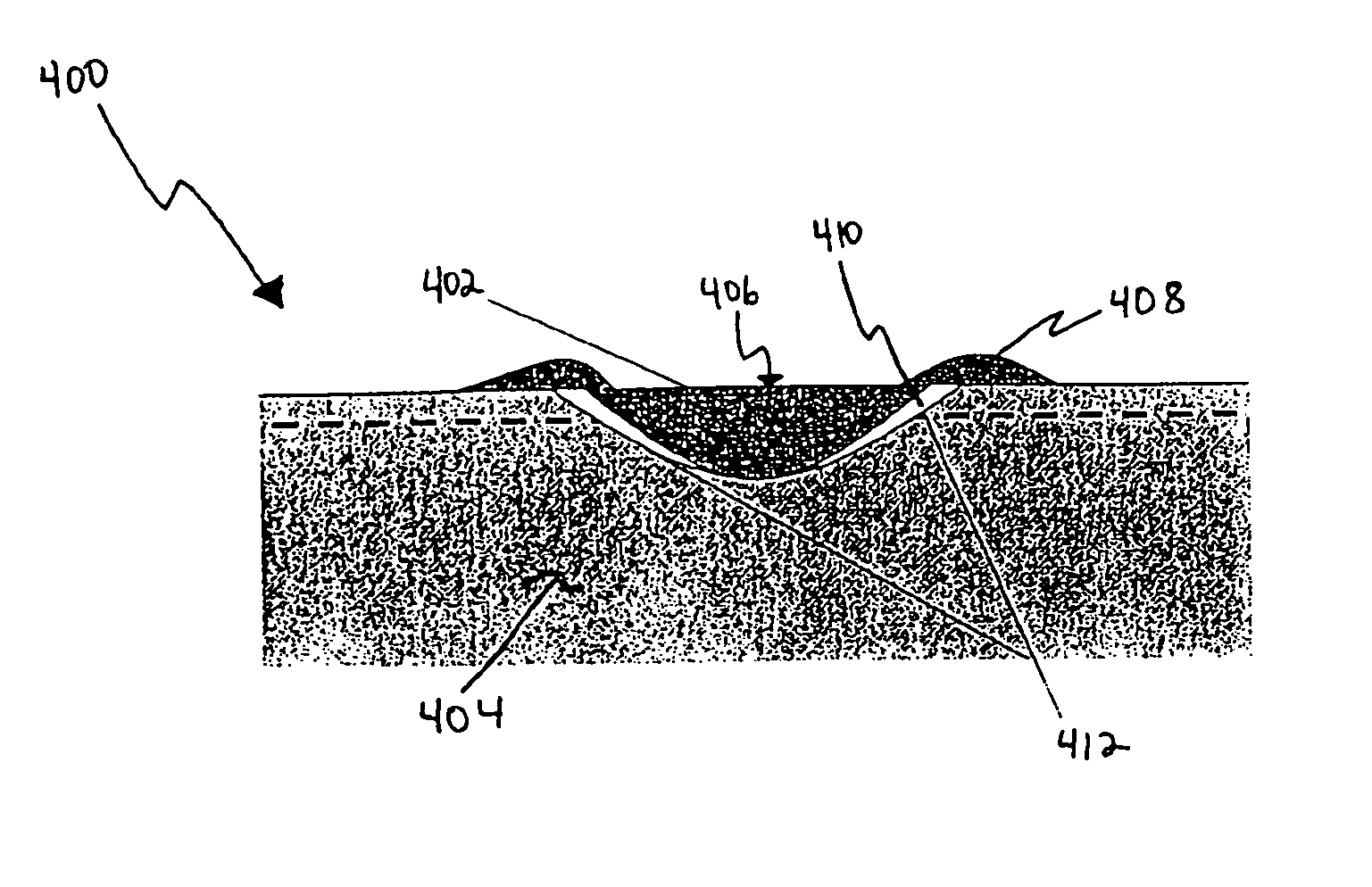 Laser marking of raw aluminum anode foil to induce uniform patterning etching