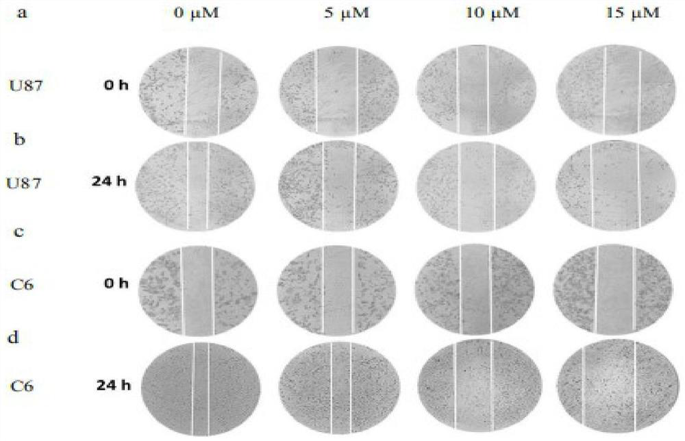 Application of doramectin in treatment of gliomas