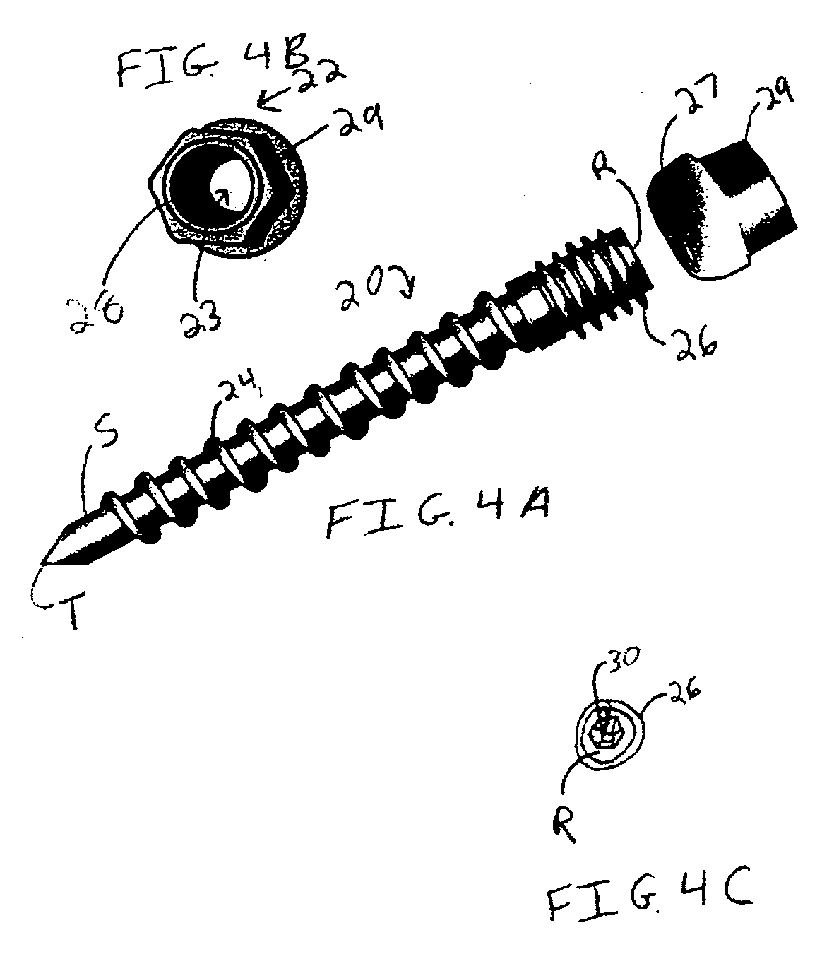 Occipitocervical plate