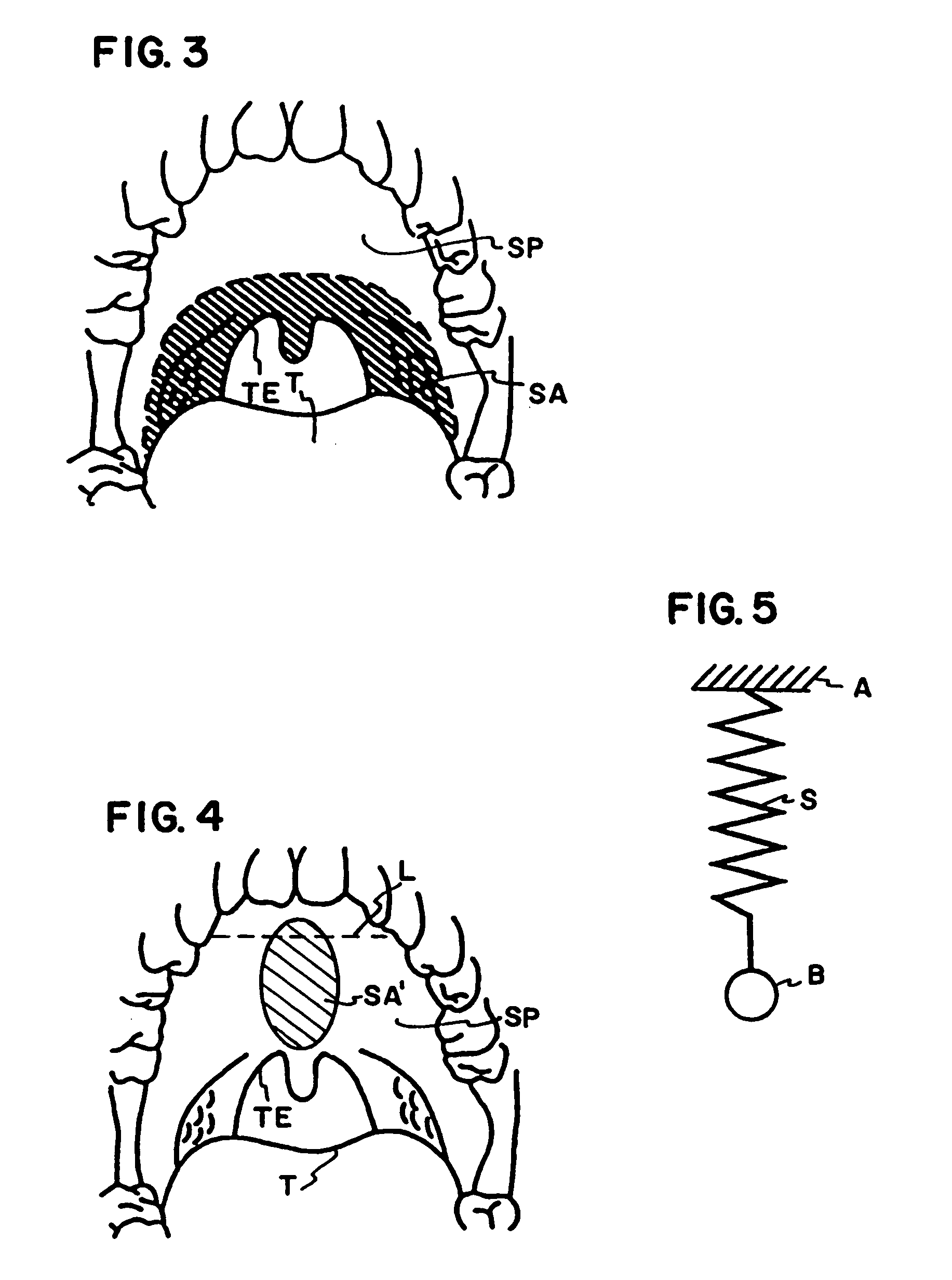 Method and apparatus to treat conditions of the naso-pharyngeal area