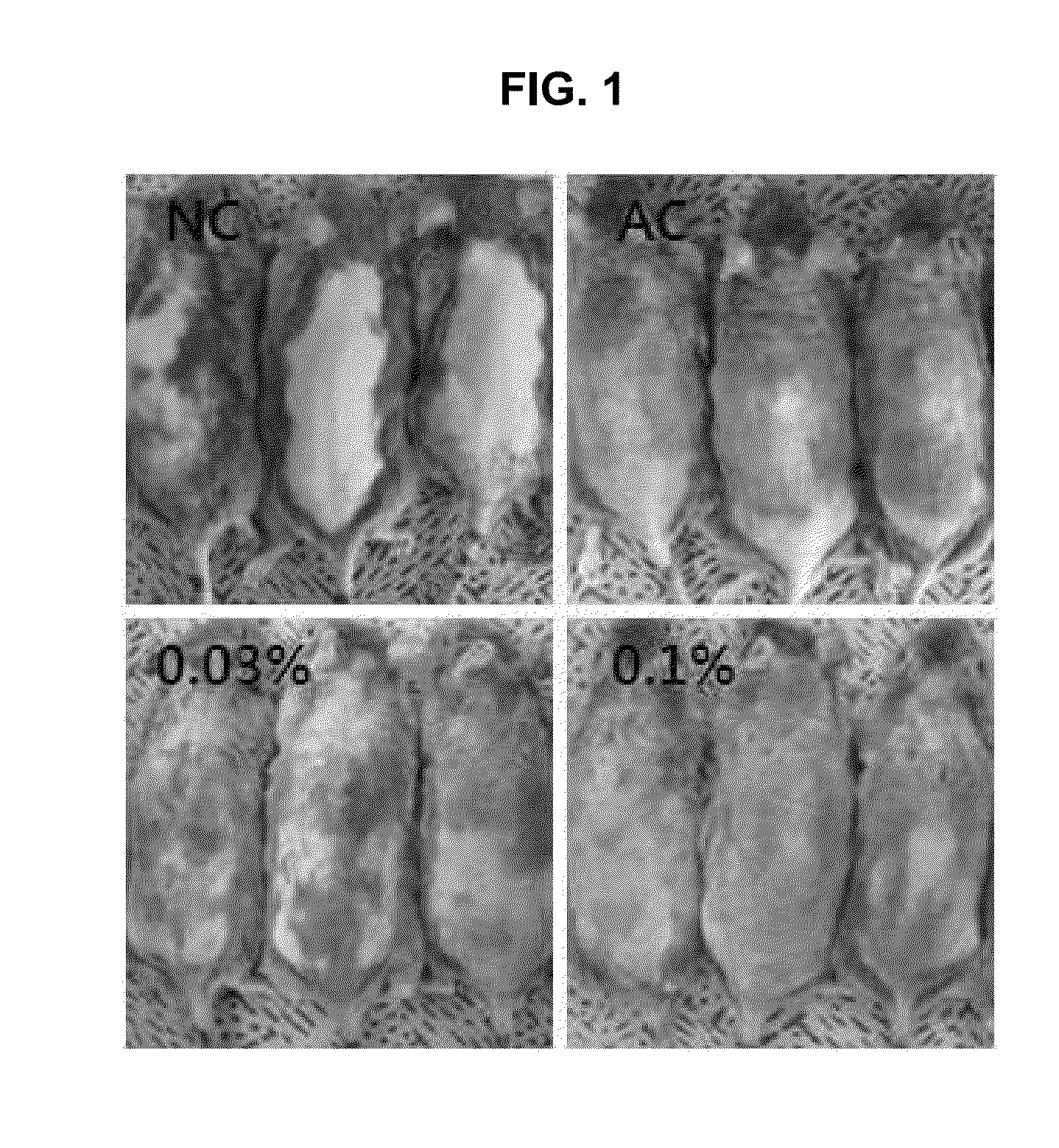 Composition comprising purine derivatives or salt thereof for preventing or treating atopic dermatitis