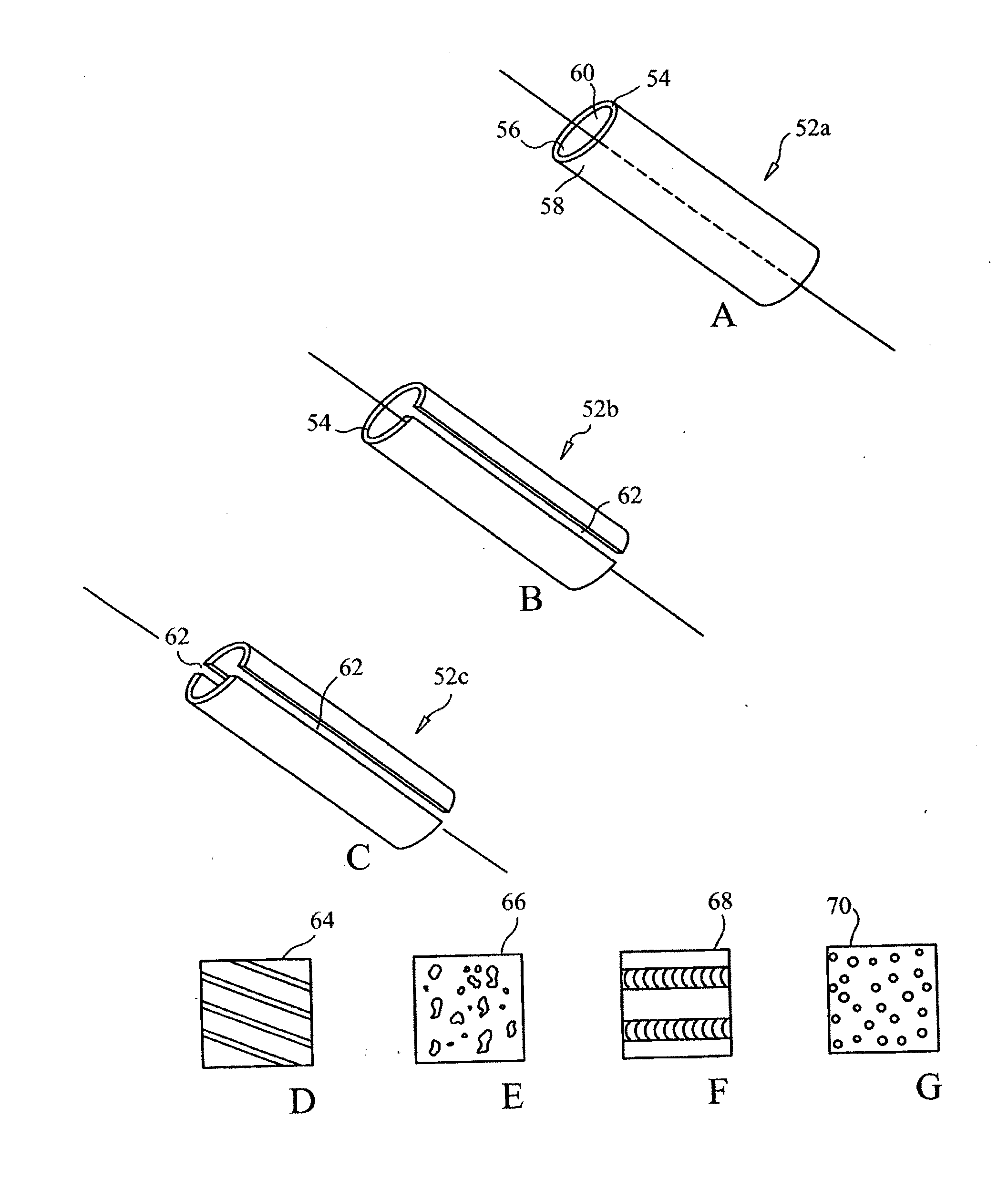 Devices and methods for stabilizing tissue and implants