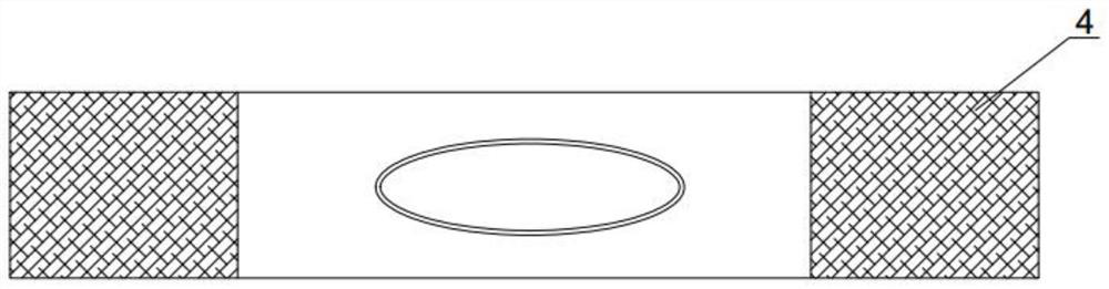 Bacteriostatic granulation-promoting ointment dressing and preparation method thereof