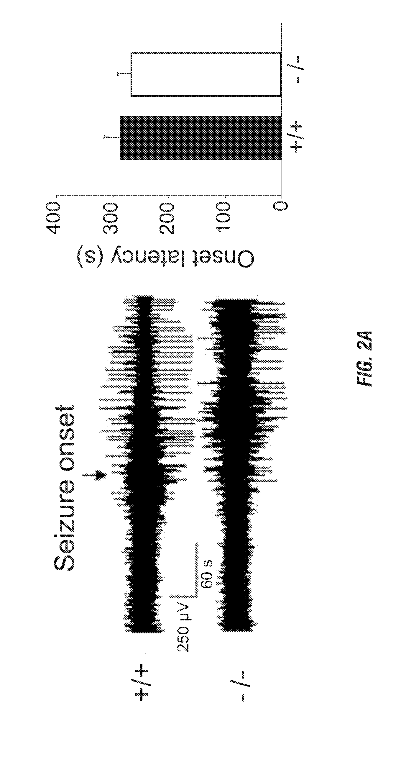 Method and compositions for treating and preventing seizures by modulating acid-sensing ion channel activity