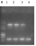 Corn chloroplast transgene expression vector containing herbicide resistant gene and application thereof