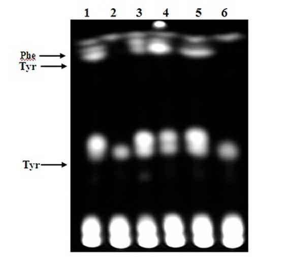 A method for detecting amino acid decarboxylase activity of spoilage bacteria in food