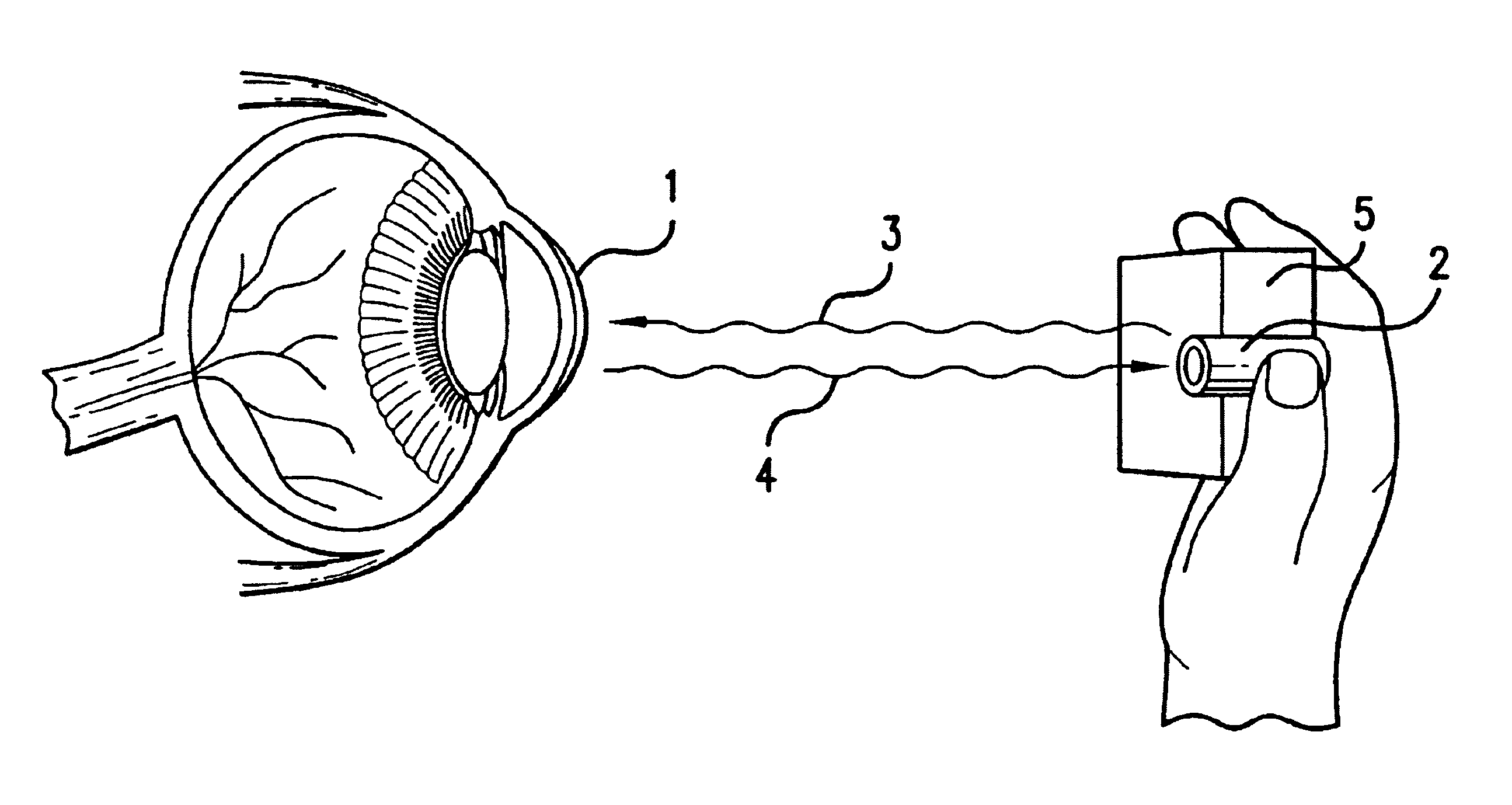 Ocular analyte sensor