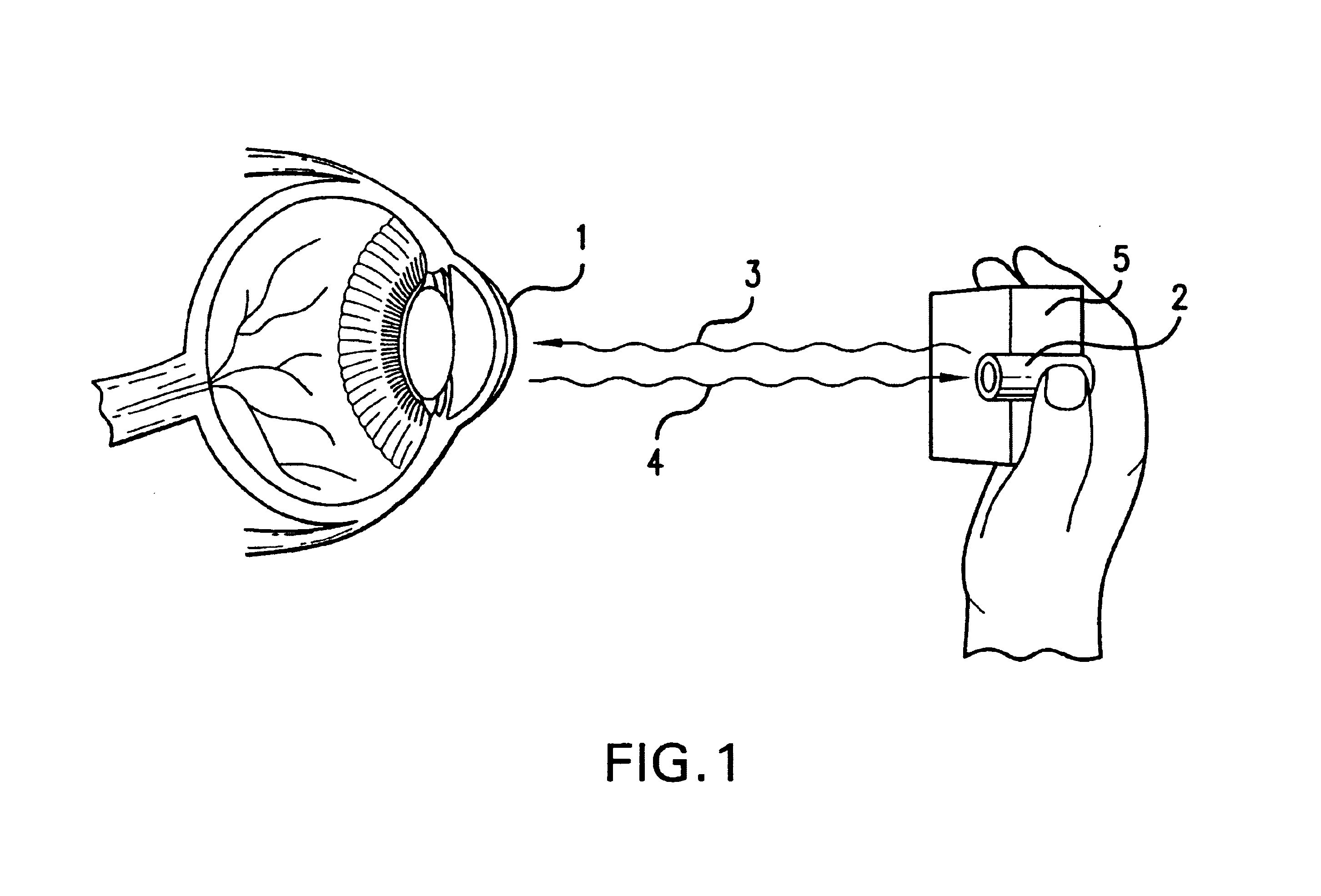 Ocular analyte sensor