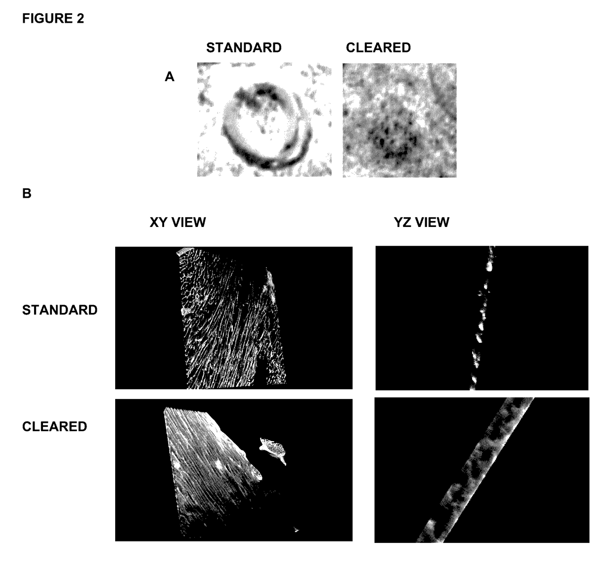 High-resolution three-dimensional imaging of mammalian hearts