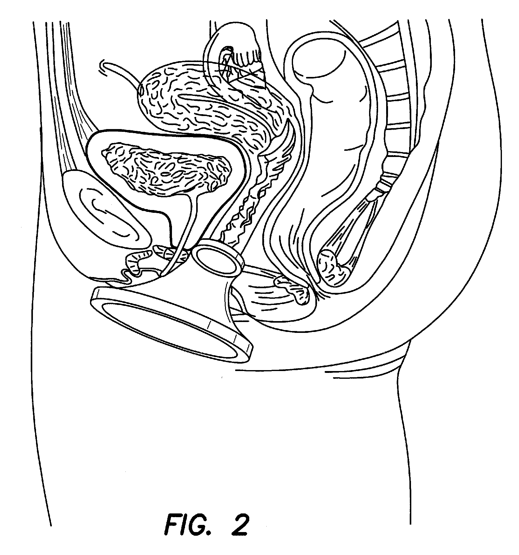 Surgical instrument access device