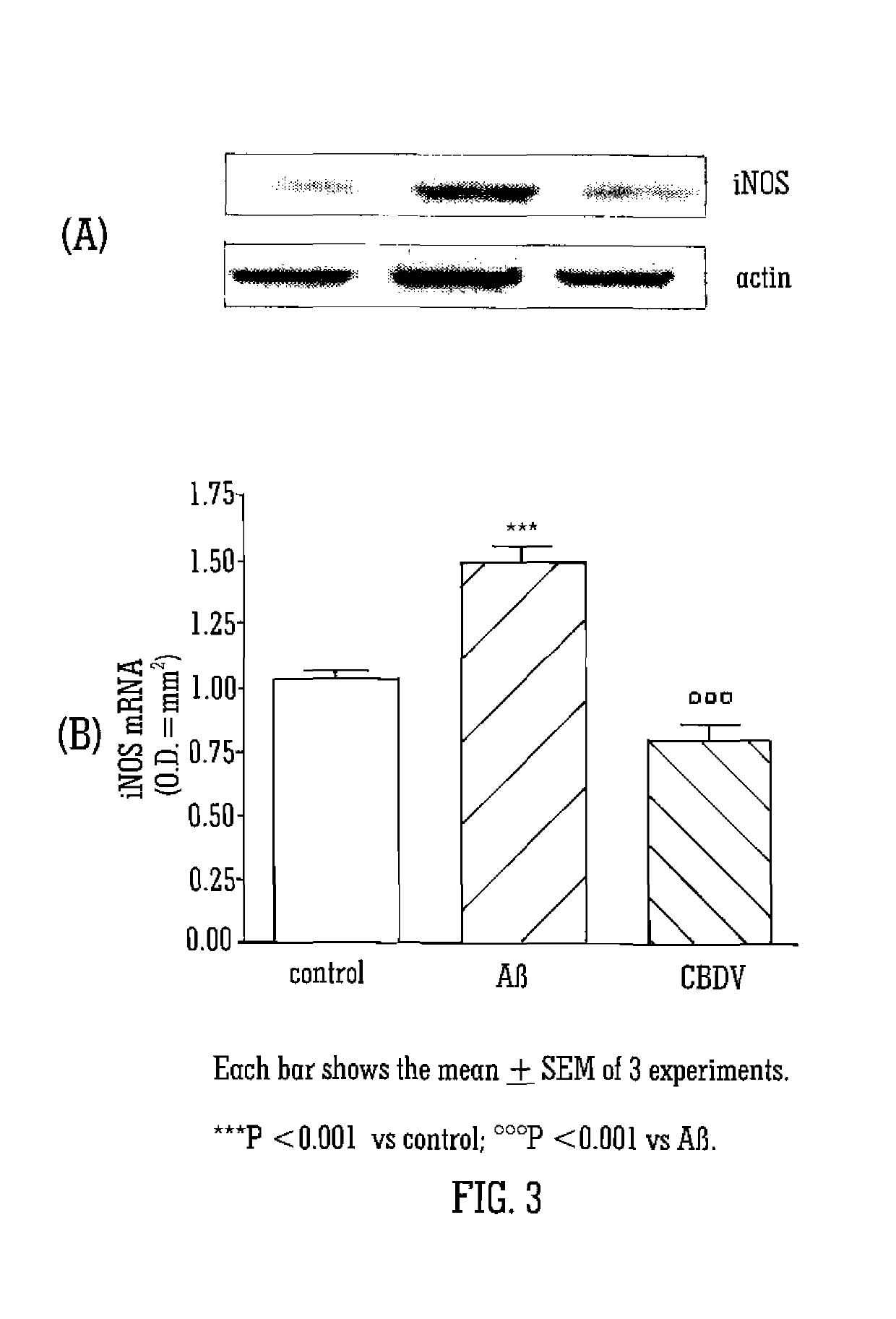 Cannabinoids for use in the treatment of neurodegenerative diseases or disorders