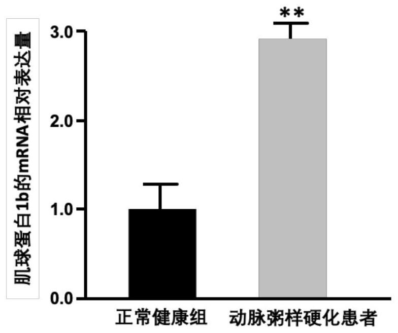 Application of myosin 1b as target for atherosclerosis diagnosis and treatment