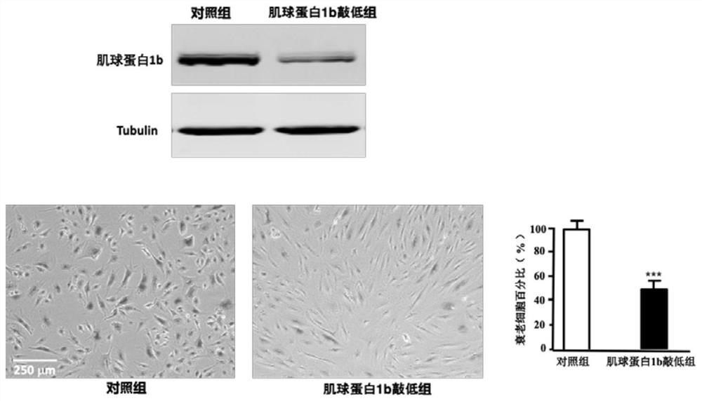 Application of myosin 1b as target for atherosclerosis diagnosis and treatment