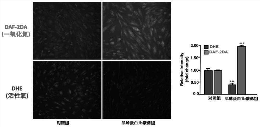 Application of myosin 1b as target for atherosclerosis diagnosis and treatment